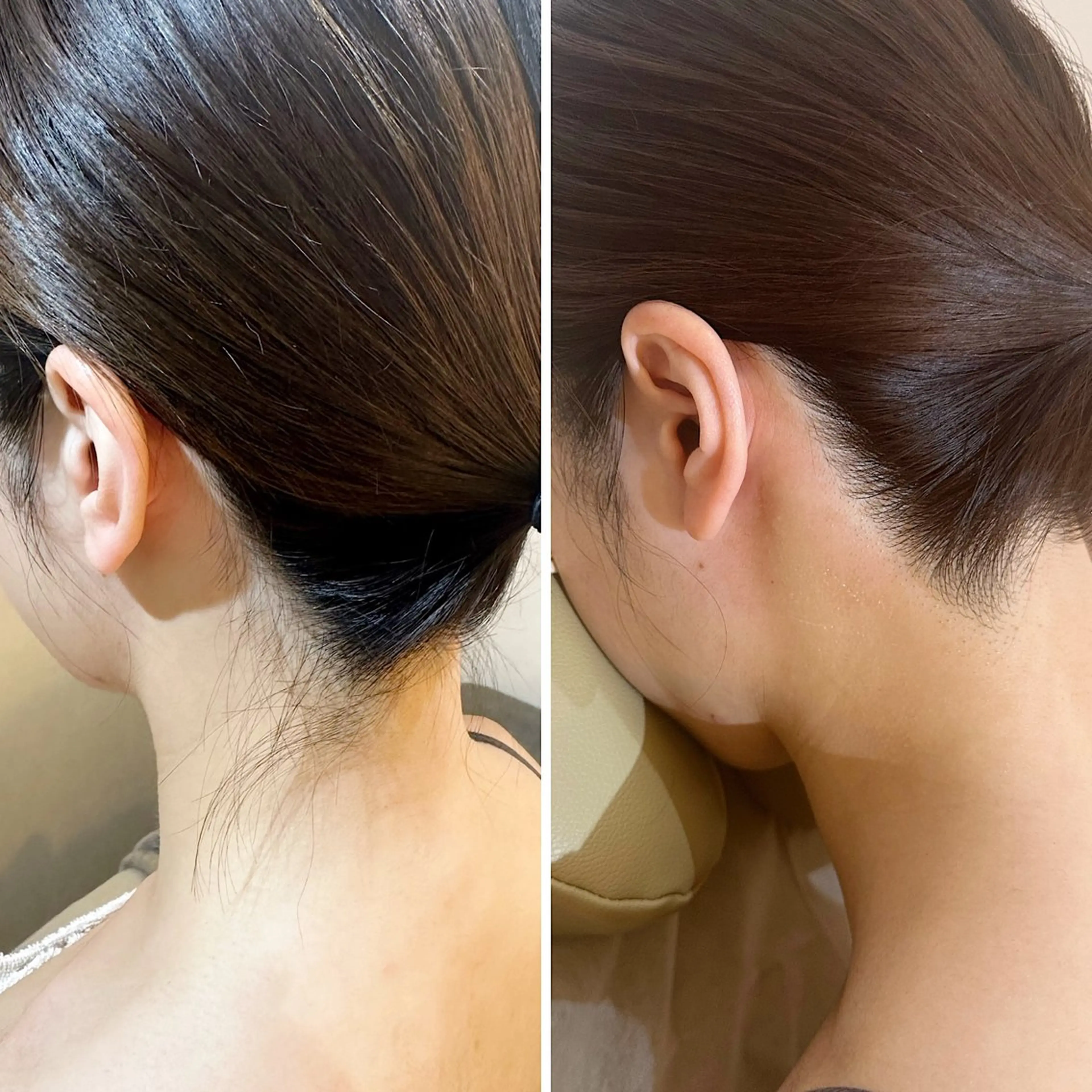 脱毛 うなじ脱毛/美肌脱毛 LABELのエステ・リラクイメージ