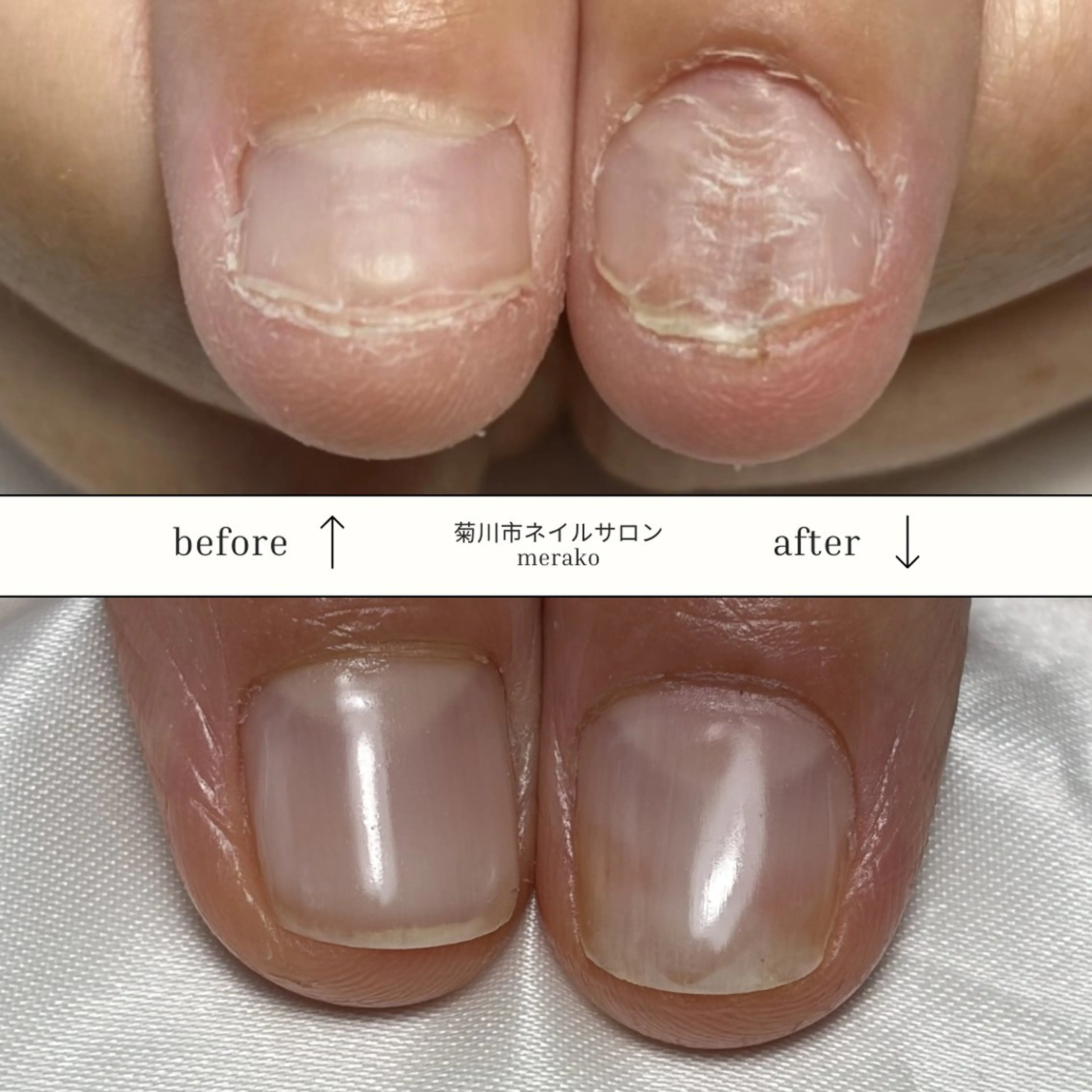 ネイル 卒業式 ハンドネイル 瀧 さなこのネイルデザイン
