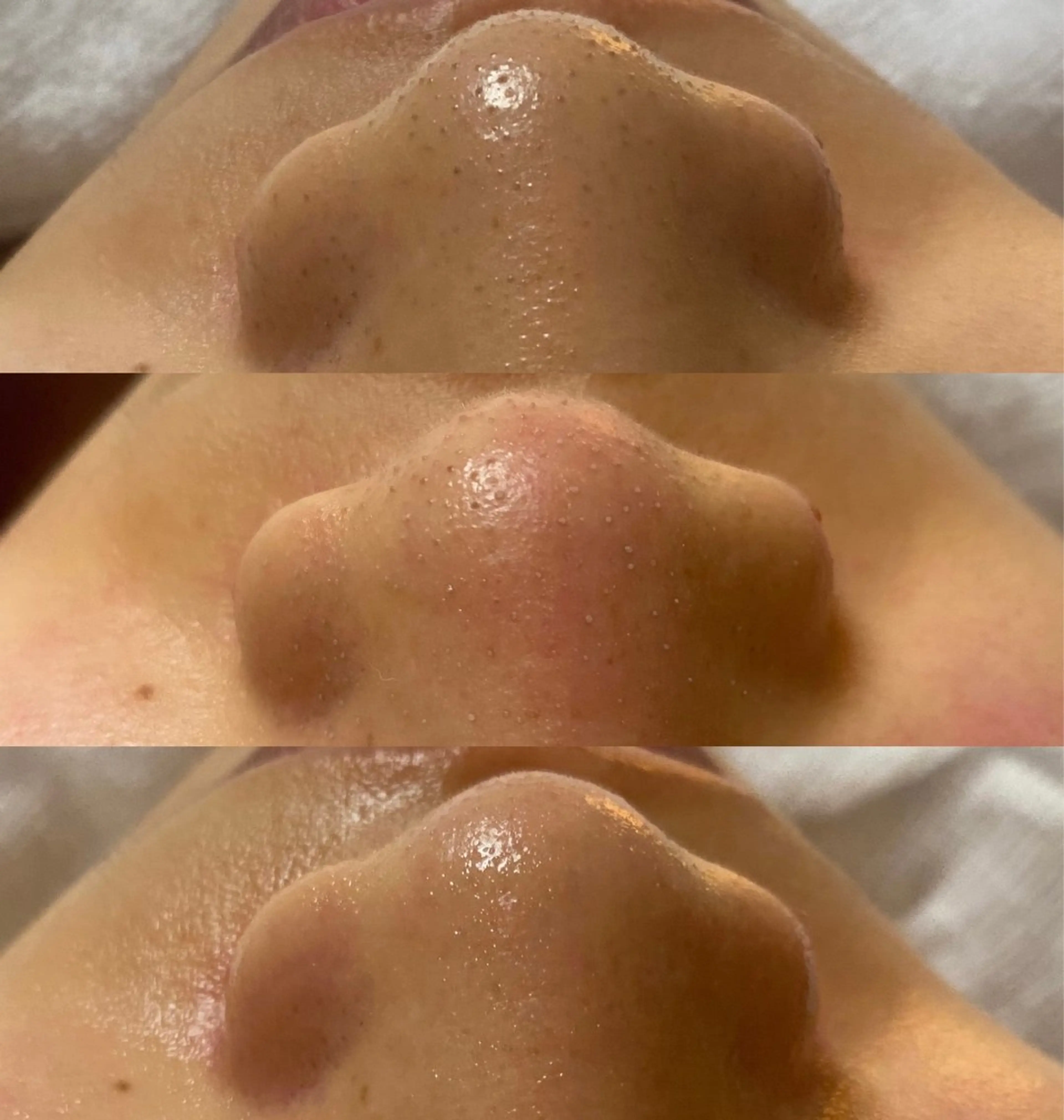 エステ AKALA hitomiのエステ・リラクイメージ