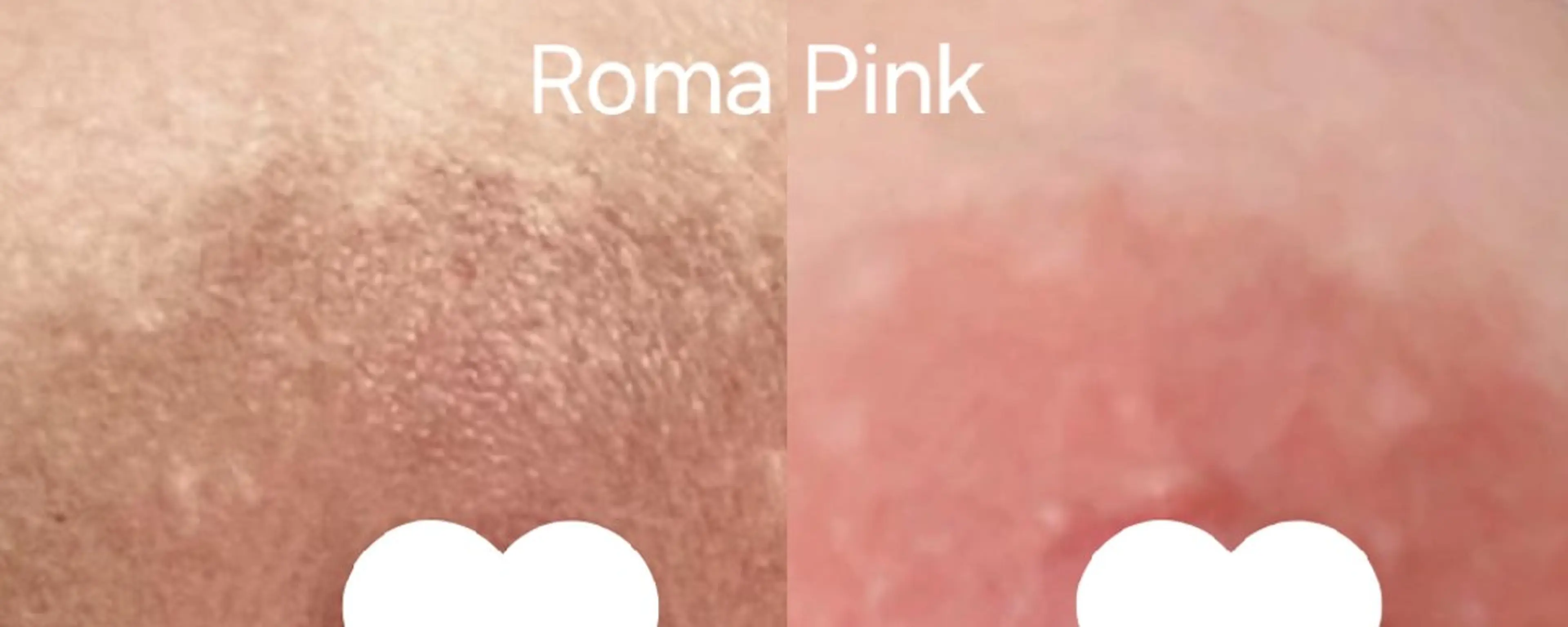 ロゼ ブランシュのエステ・リラクイメージ