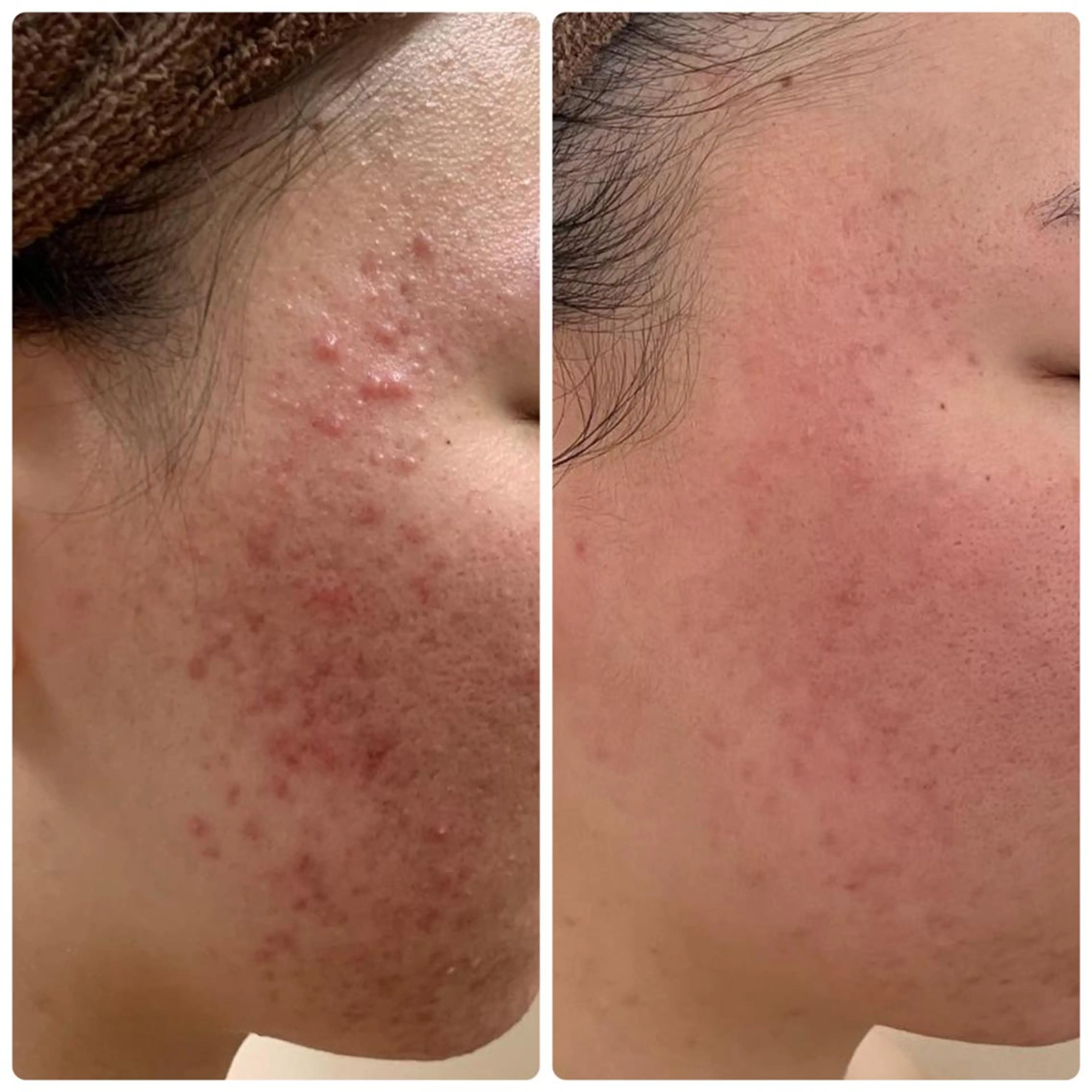 エステ ♡RAYVIS♡ 名古屋店　神田のエステ・リラクイメージ