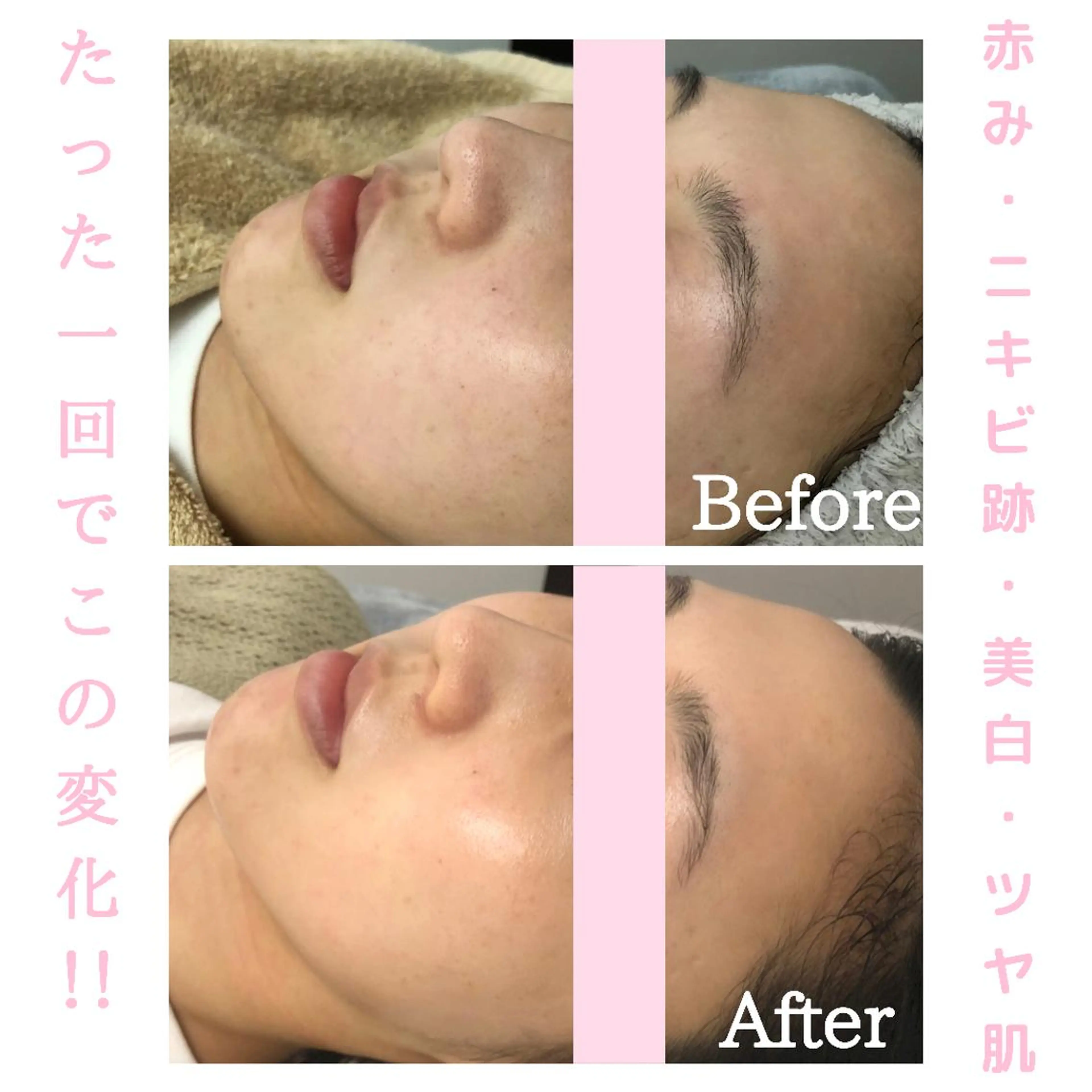 BestBelleꕤ 大阪福島/肌質改善のエステ・リラクイメージ