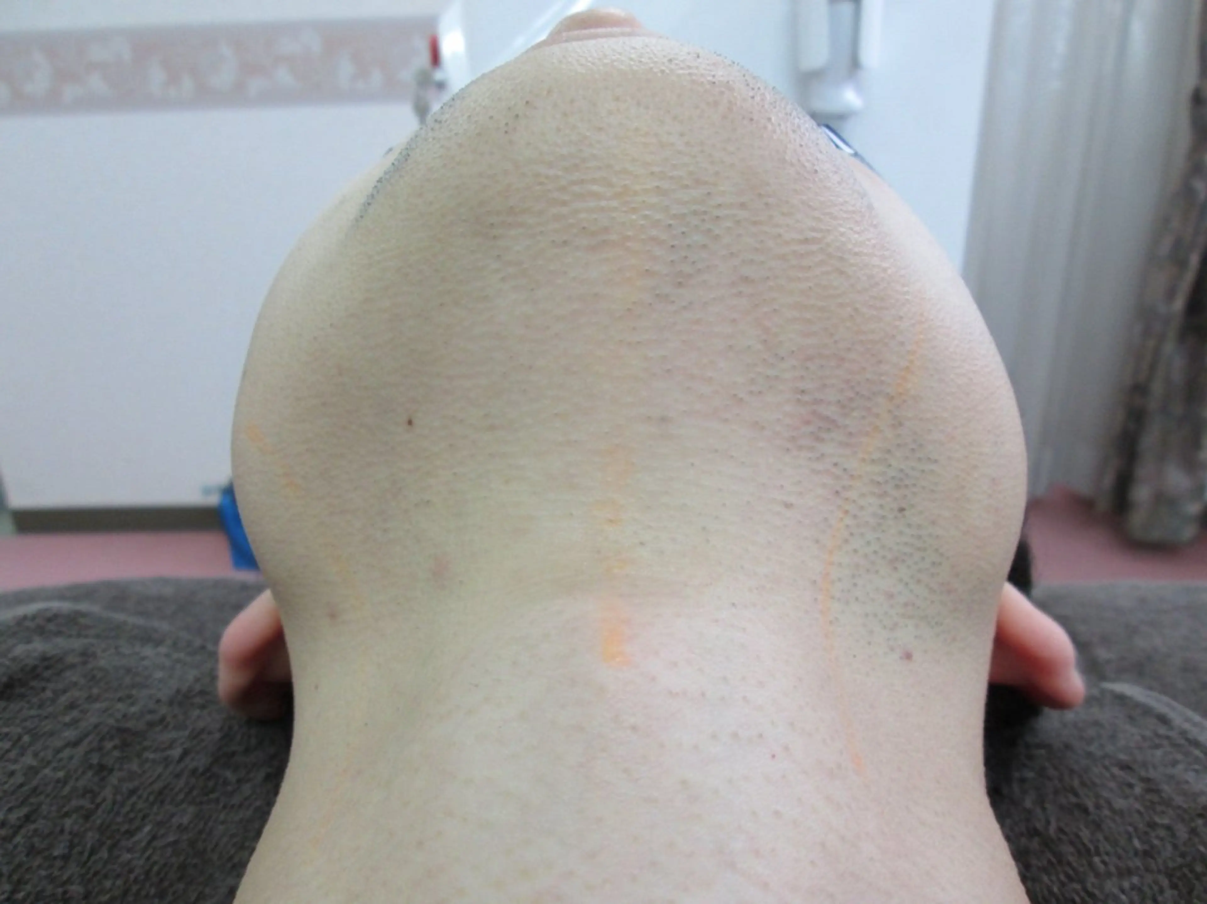 メンズ 脱毛 ☀️Akala☀️ メンズ脱毛のエステ・リラクイメージ