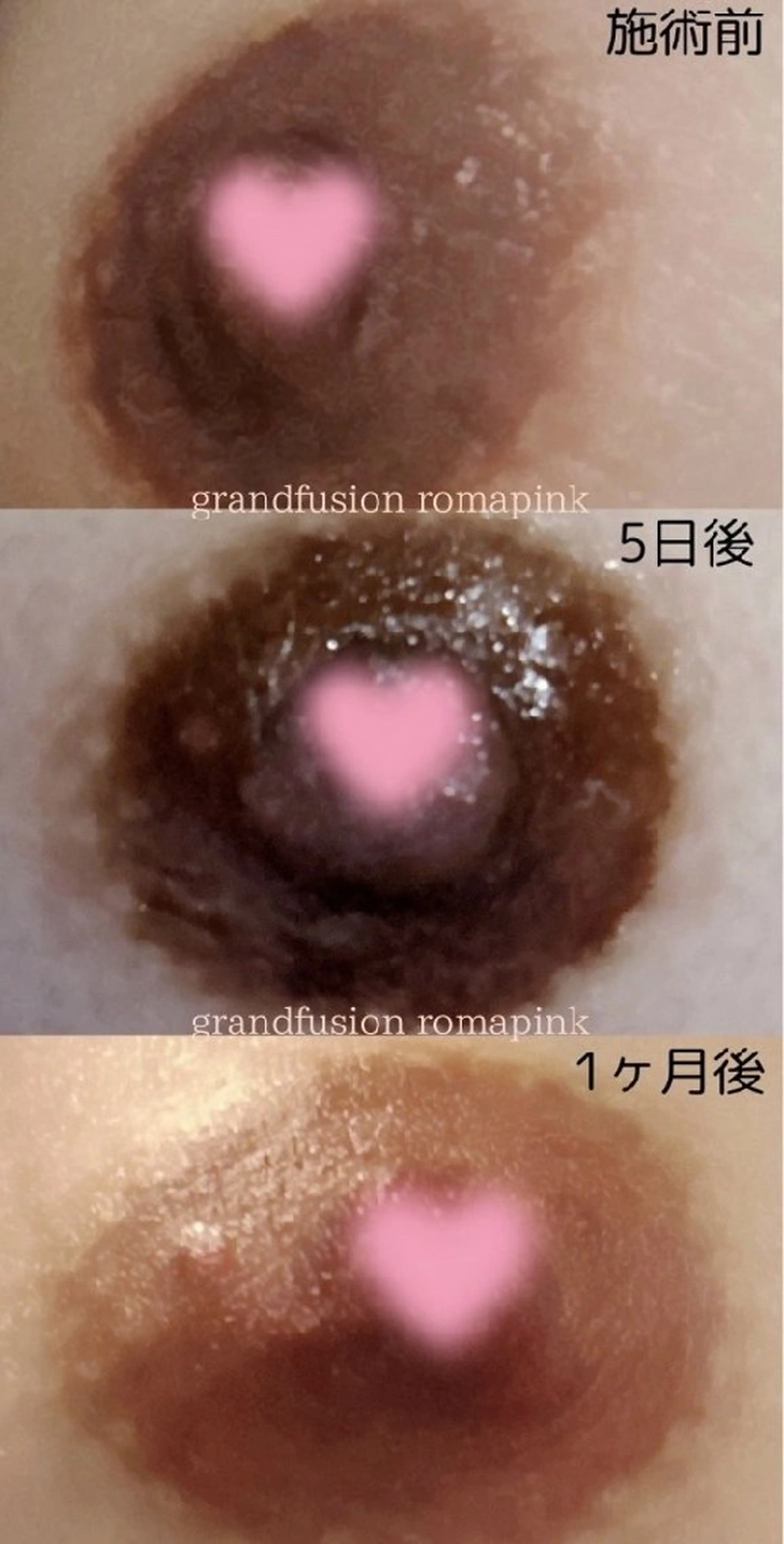 ロゼ ブランシュのエステ・リラクイメージ