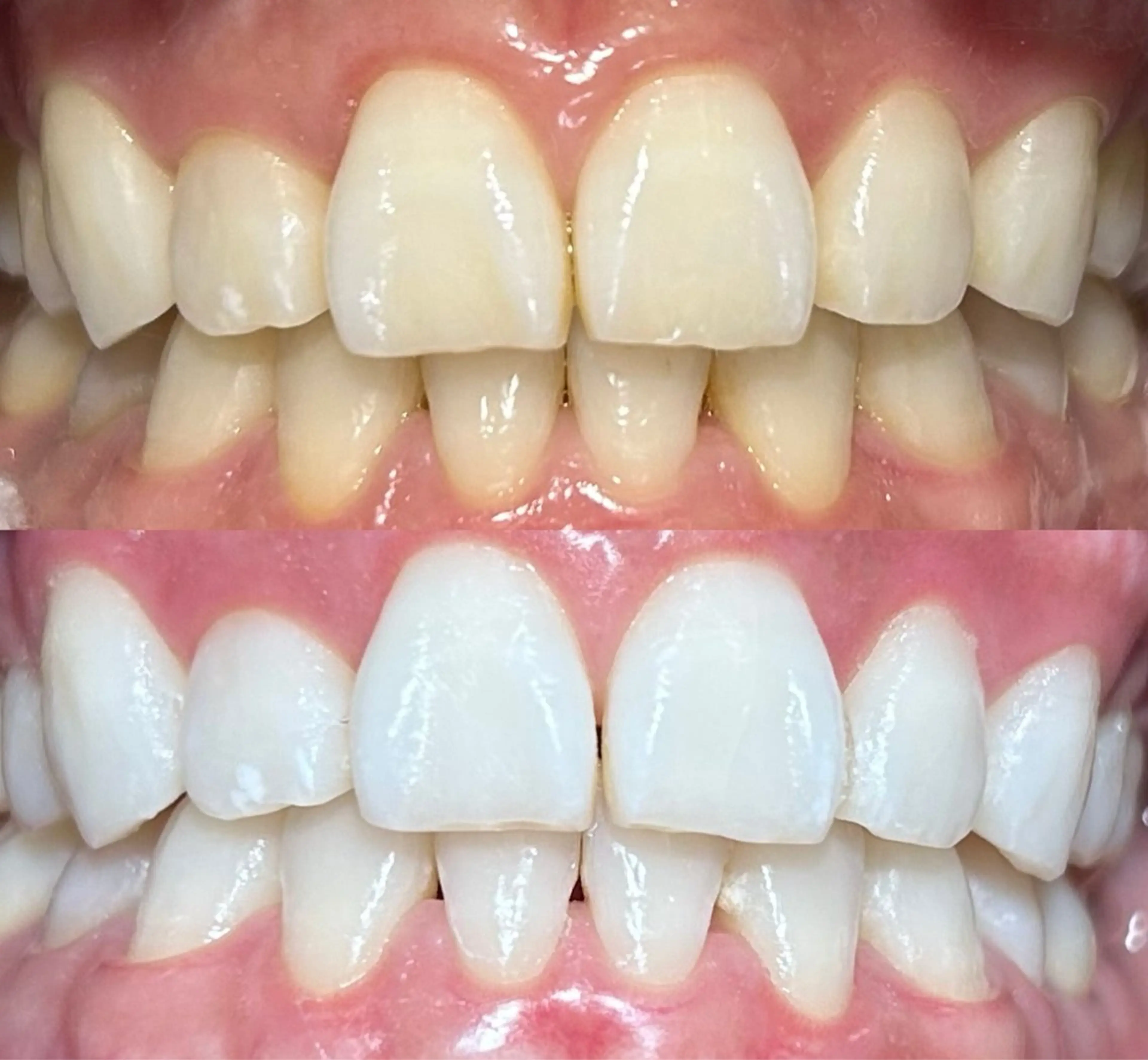 io teeth careのその他イメージ