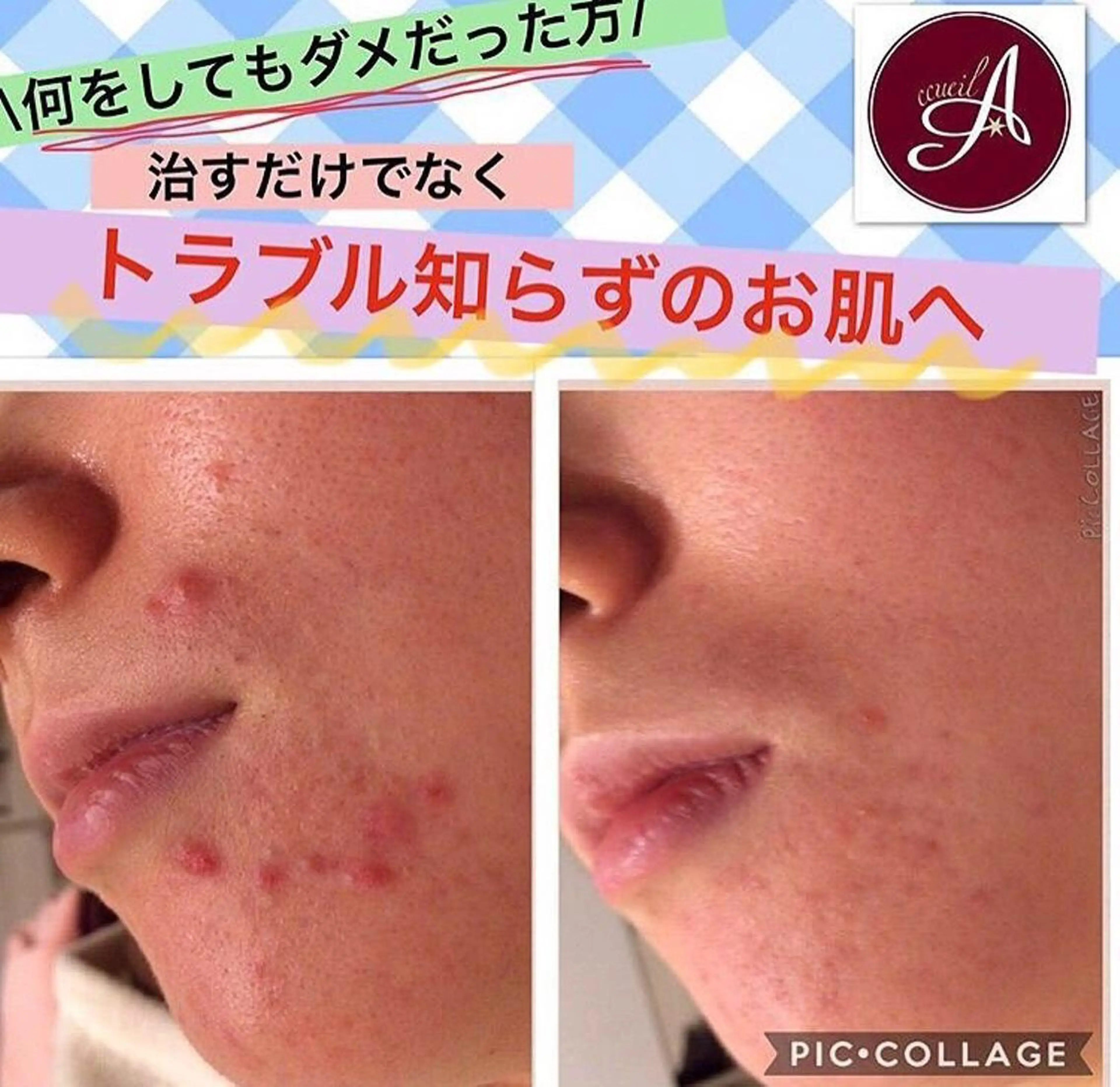 ミディアム パーマ ヘアアレンジ メンズ キッズ ネイル マツエク・マツパ ニキビ・肌質改善専門 ♡人生が変わるサロンのエステ・リラクイメージ