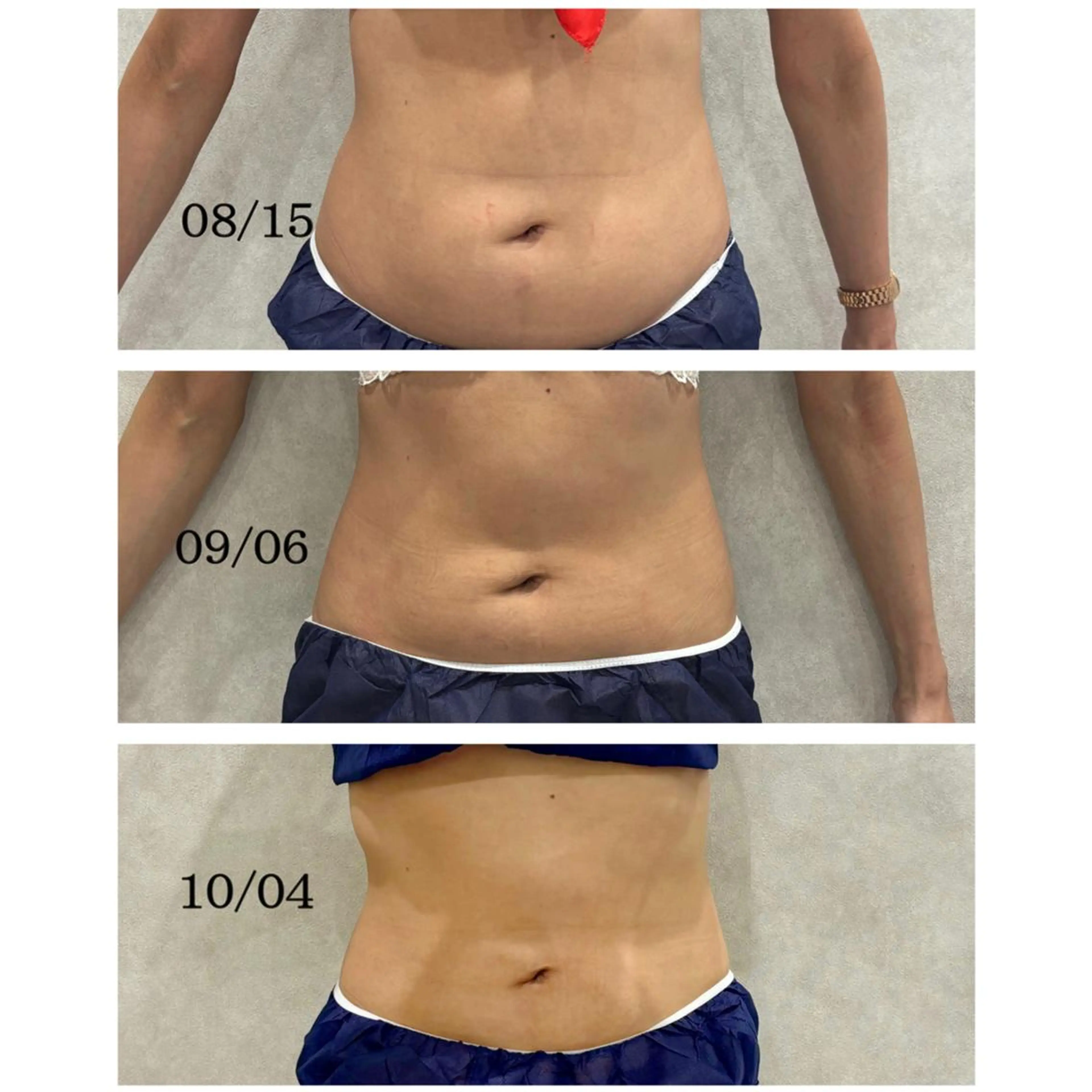 心斎橋🤍堀江.小顔 ハーブ.痩身クレビアのエステ・リラクイメージ