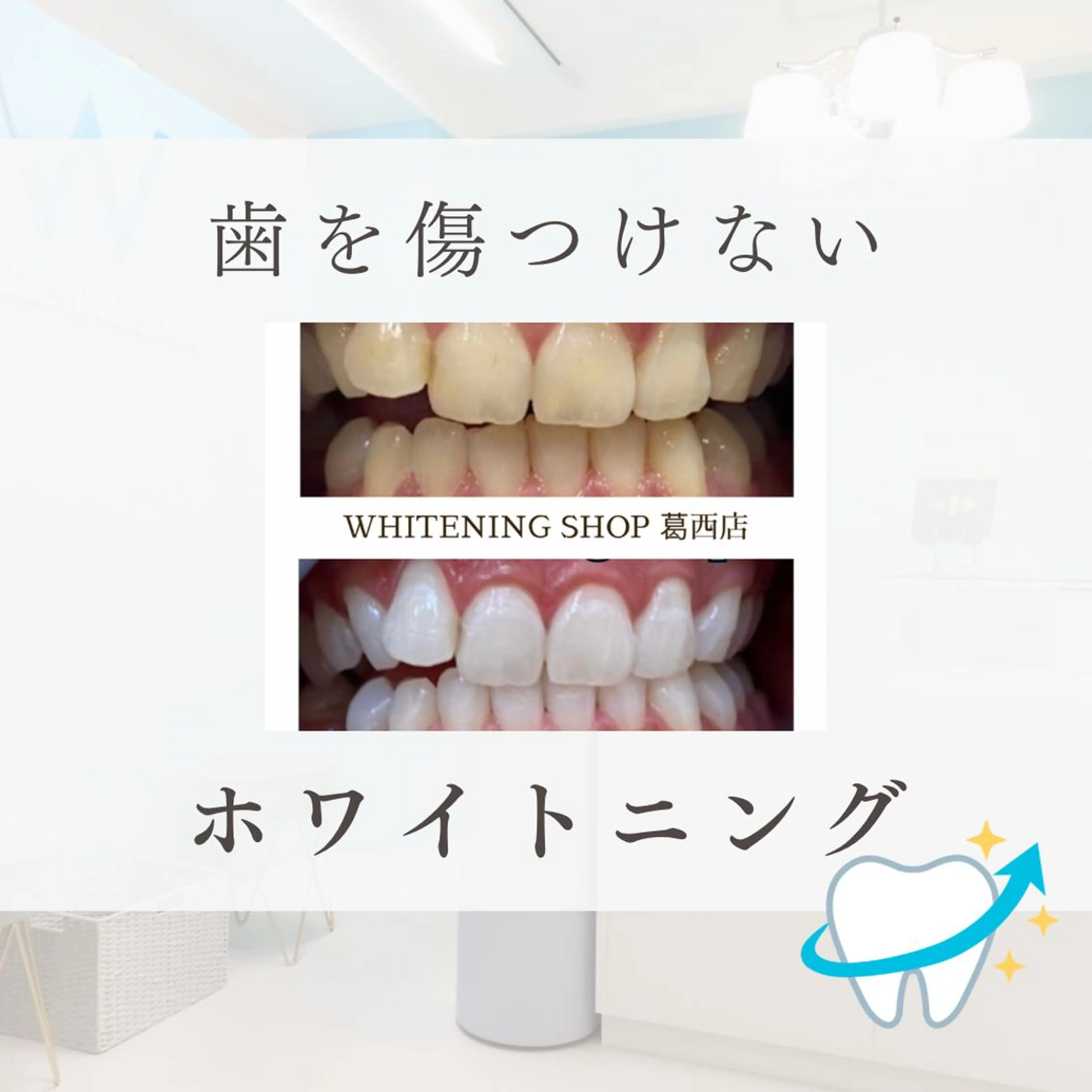 メンズ その他 ホワイトニング ショップ葛西店のその他イメージ