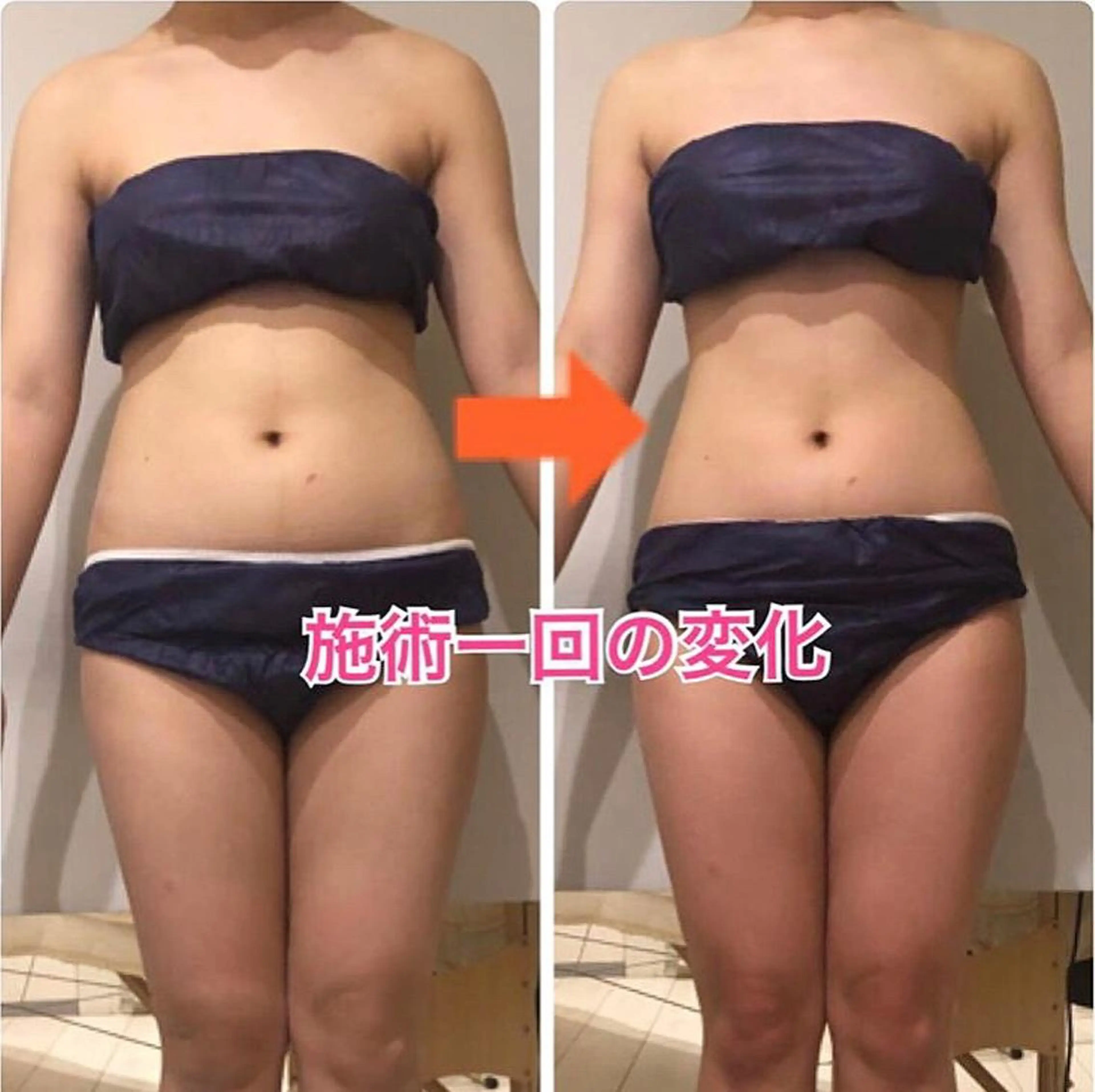 ショート カラー パーマ ヘアアレンジ メンズ キッズ ネイル マツエク・マツパ ‍痩身＆ボディ 結果出し🌟丹野のエステ・リラクイメージ