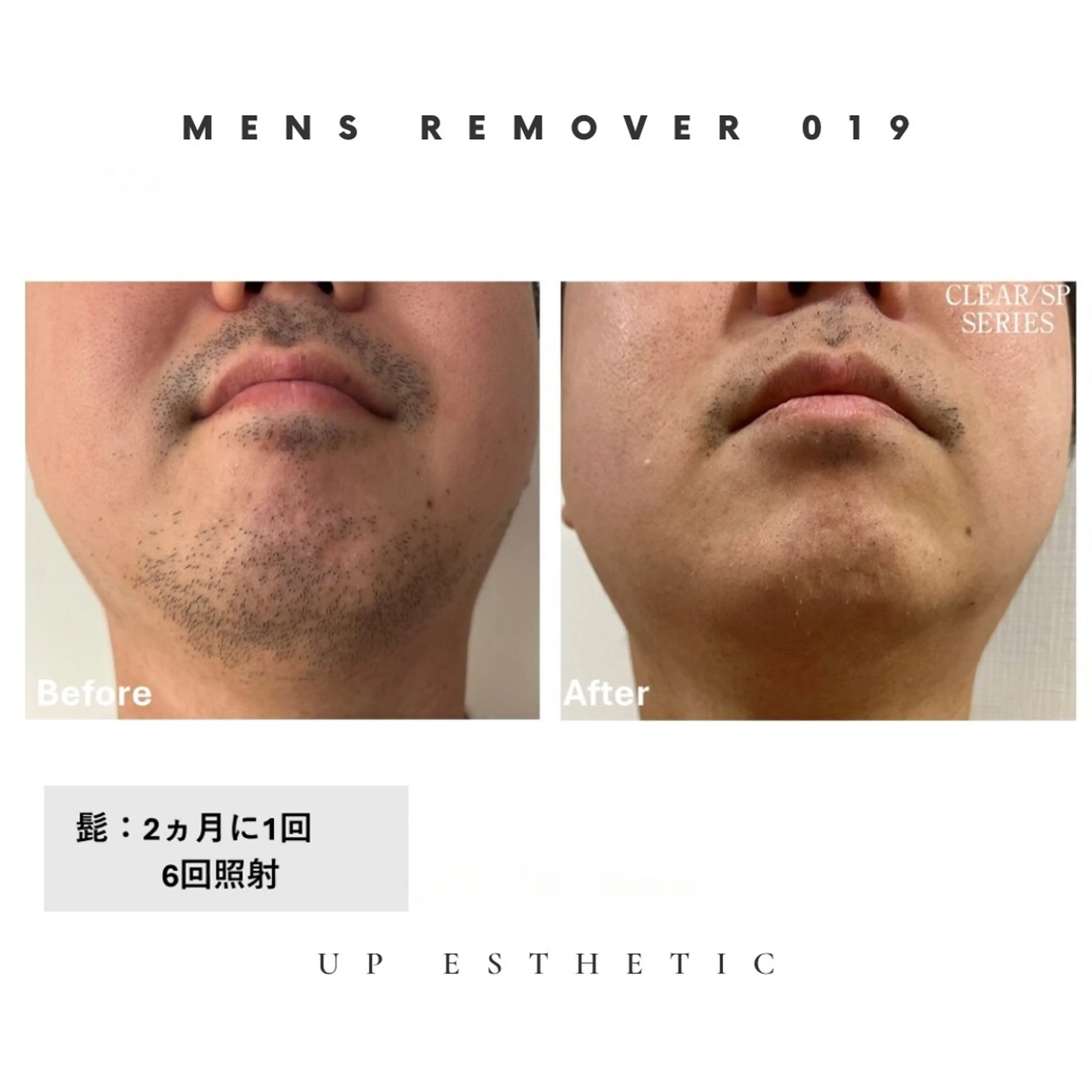 メンズ 脱毛 韓国肌管理 ウプエステティックのエステ・リラクイメージ