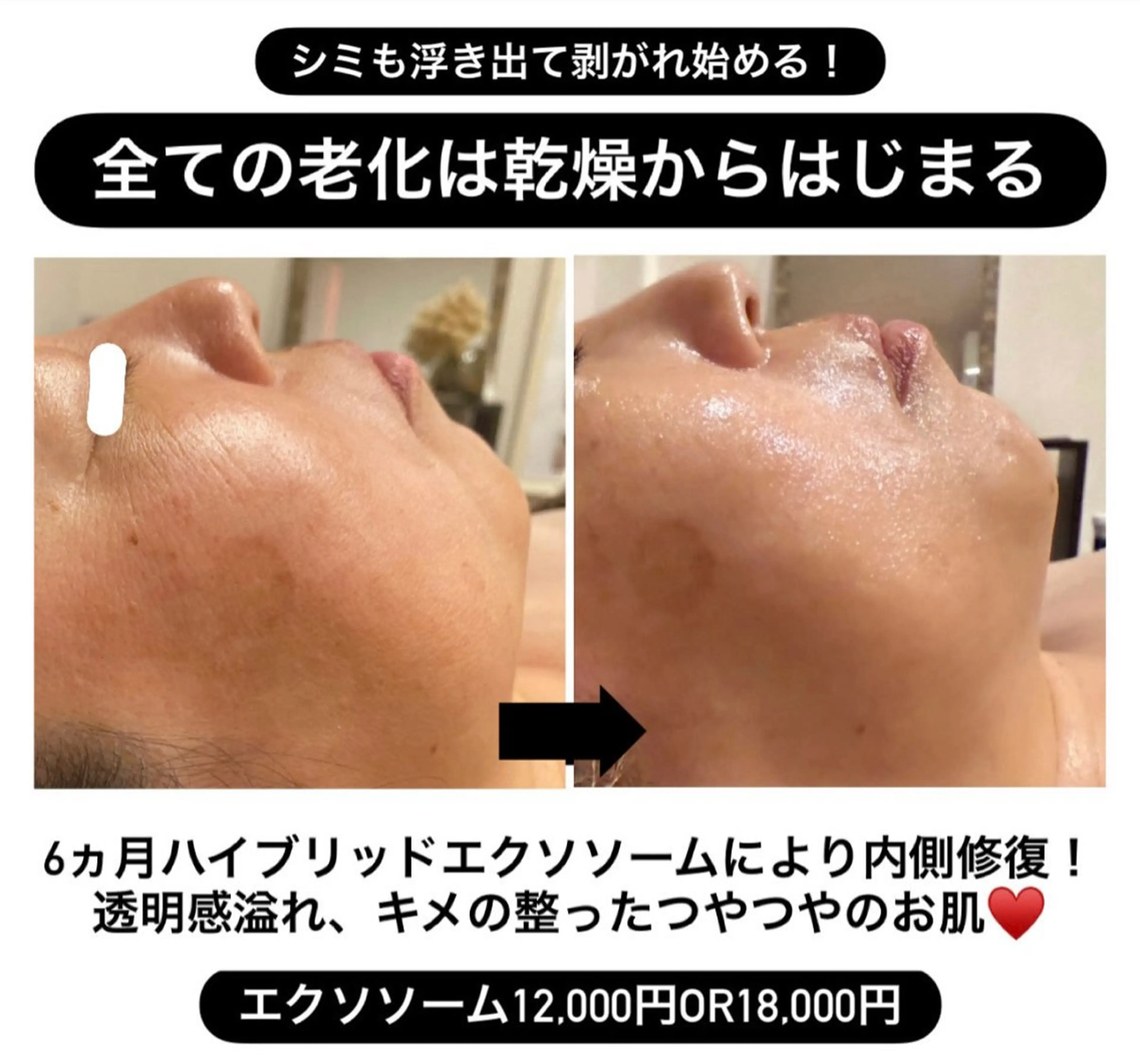 エステ 太田 女久美のエステ・リラクイメージ