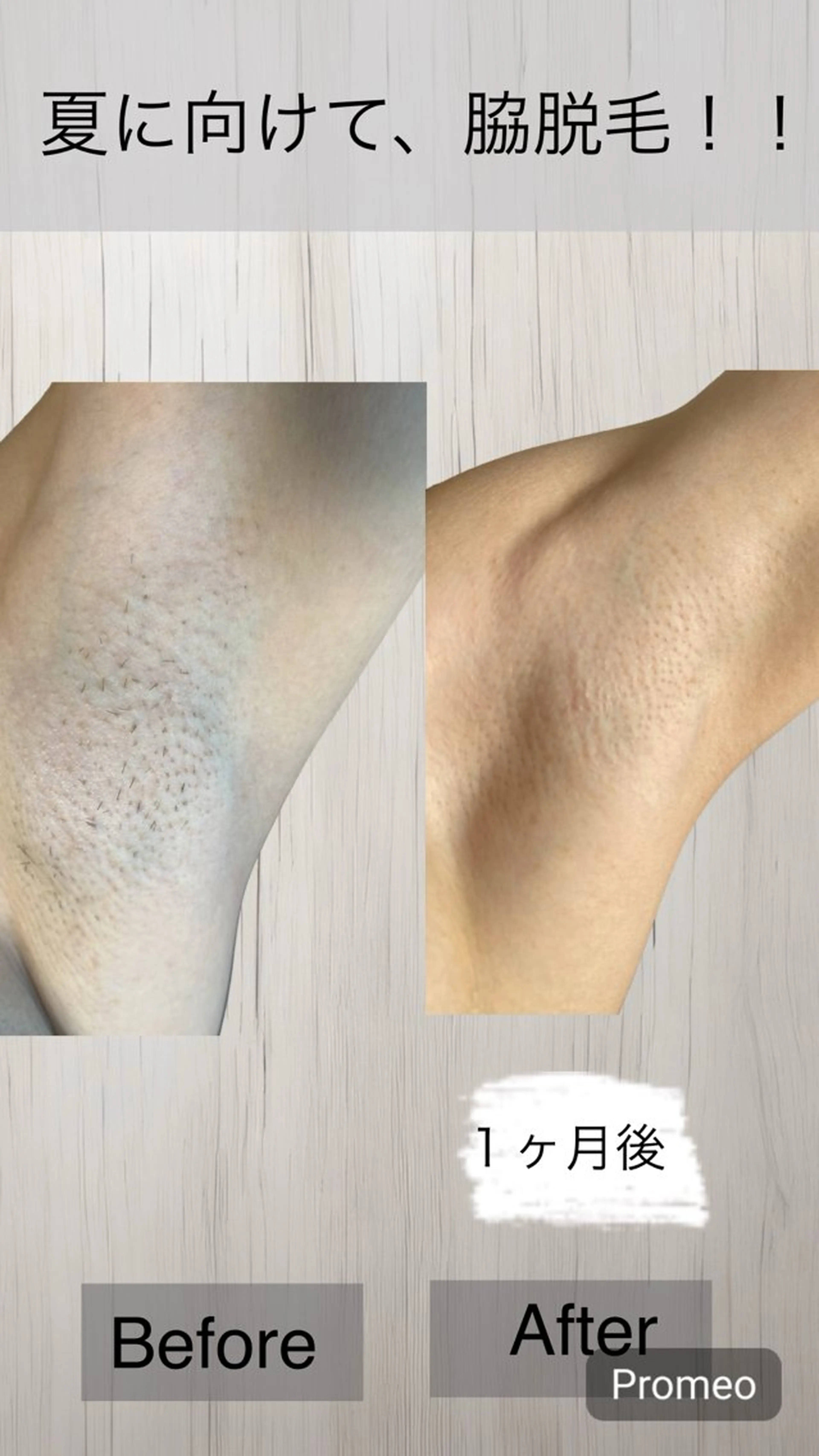 脱毛 岡口 公子のエステ・リラクイメージ