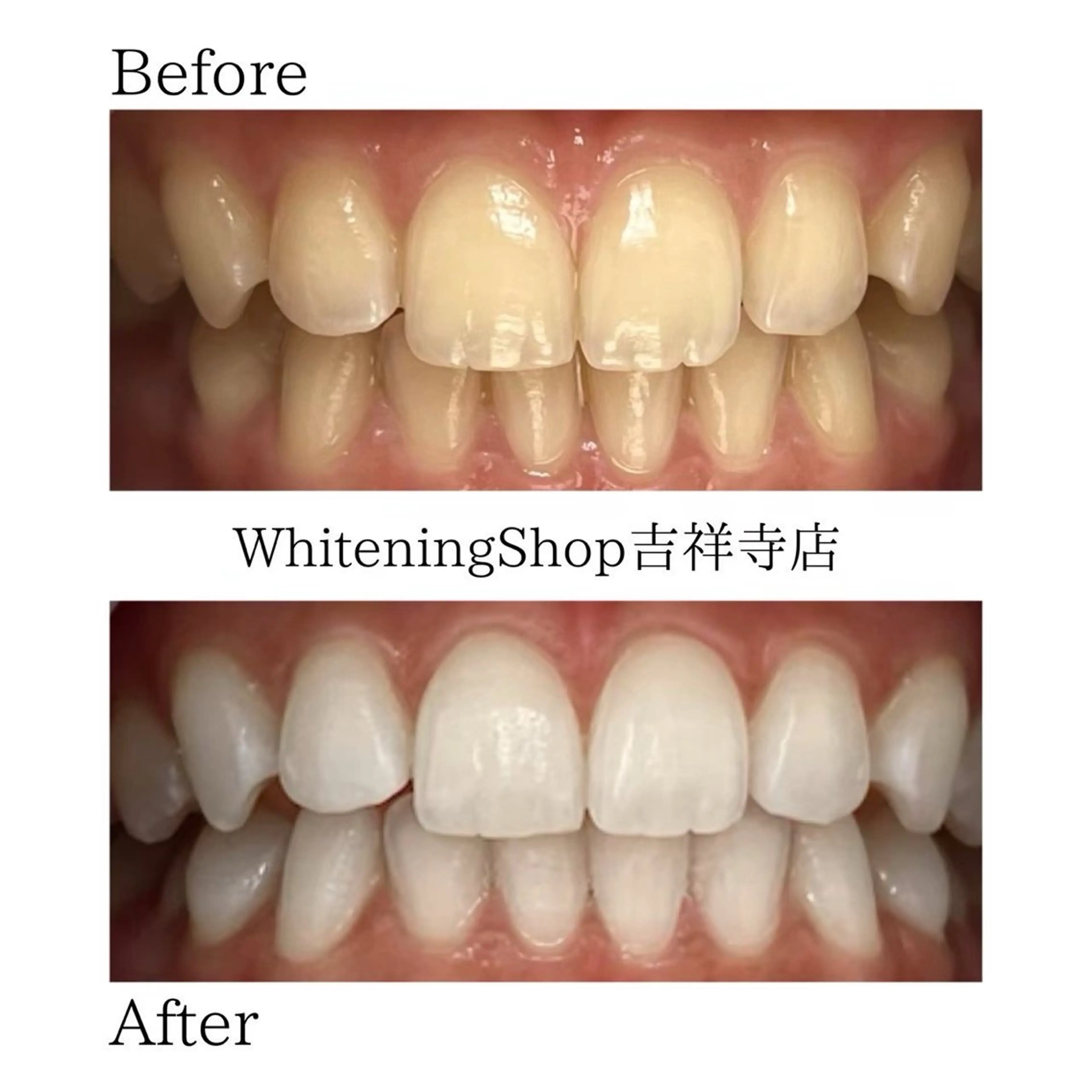 ホワイトニングショッ 吉祥寺2号店のその他イメージ