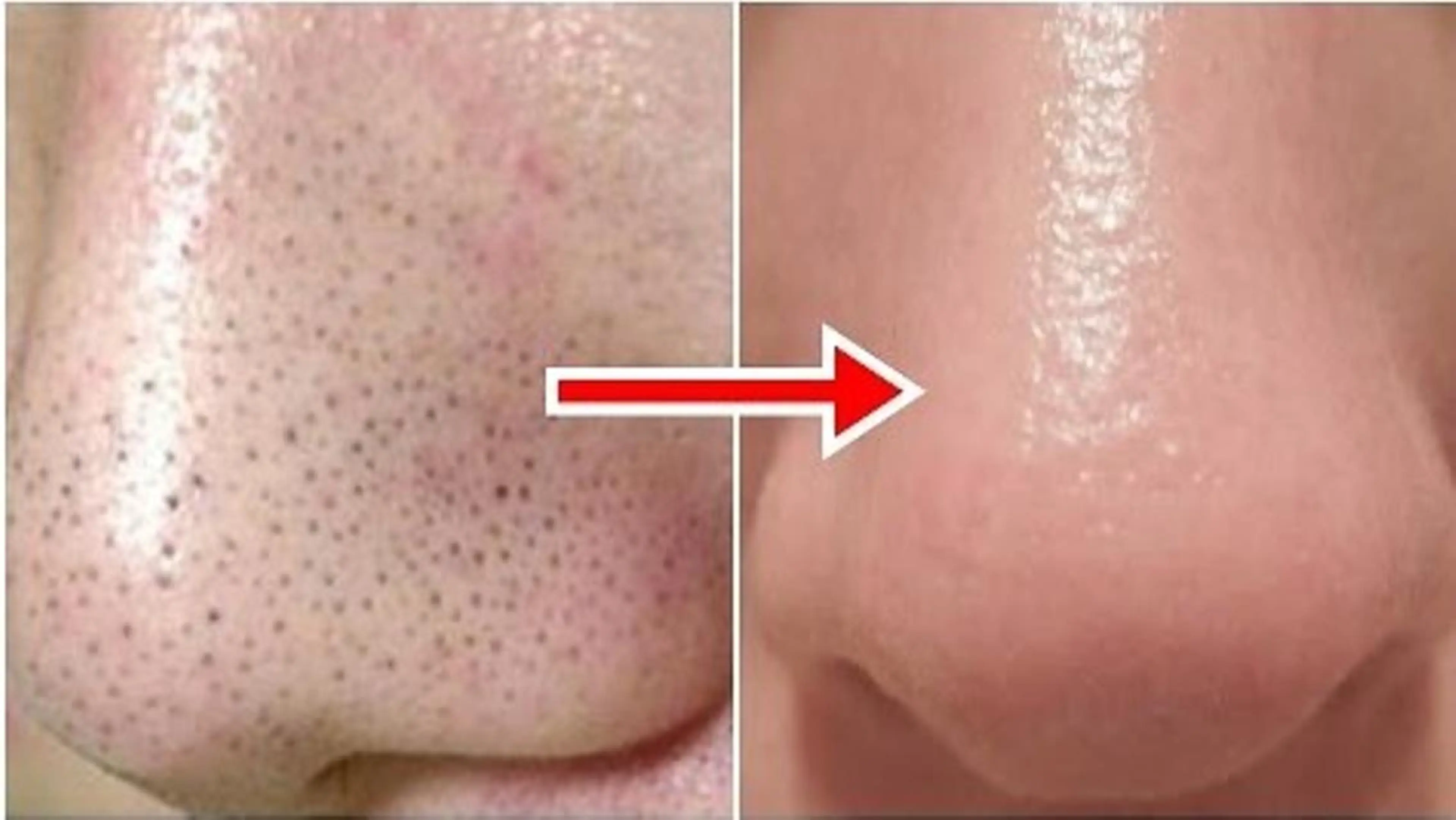 肌ケア＆毛穴洗浄 Cheri/女性専用のエステ・リラクイメージ