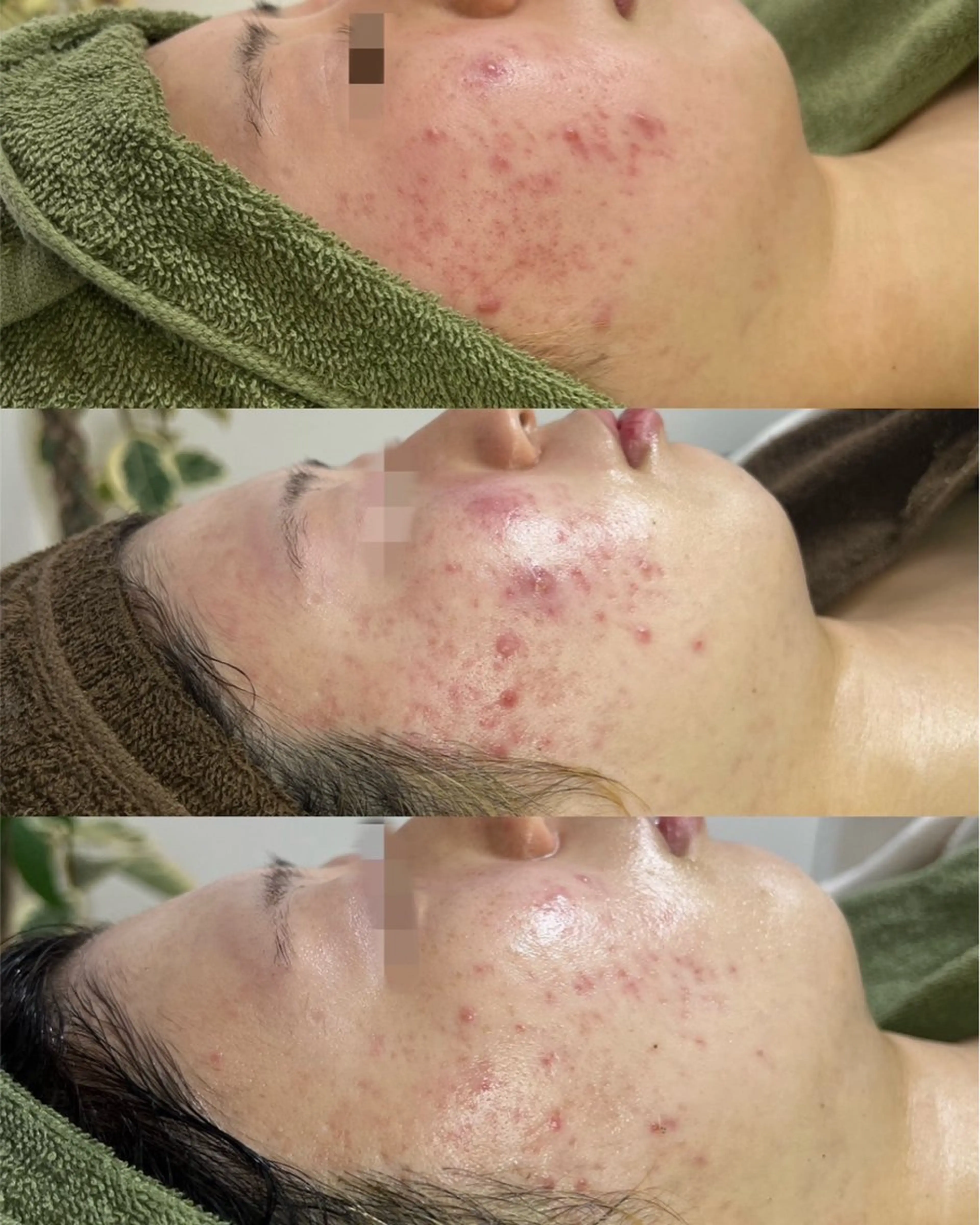 LukeBeauty salonのエステ・リラクイメージ