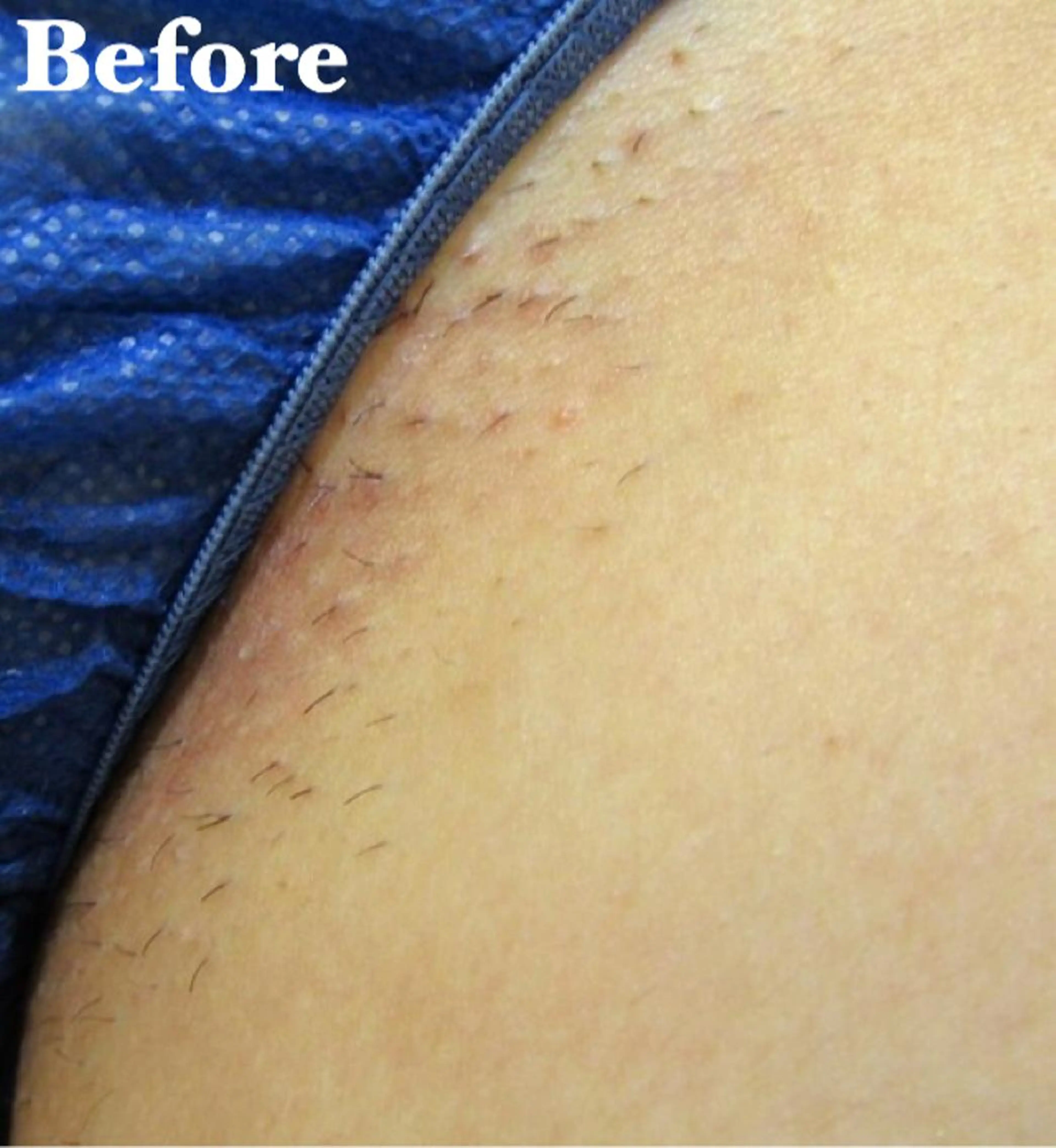 MIMI 吉祥寺本店のエステ・リラクイメージ