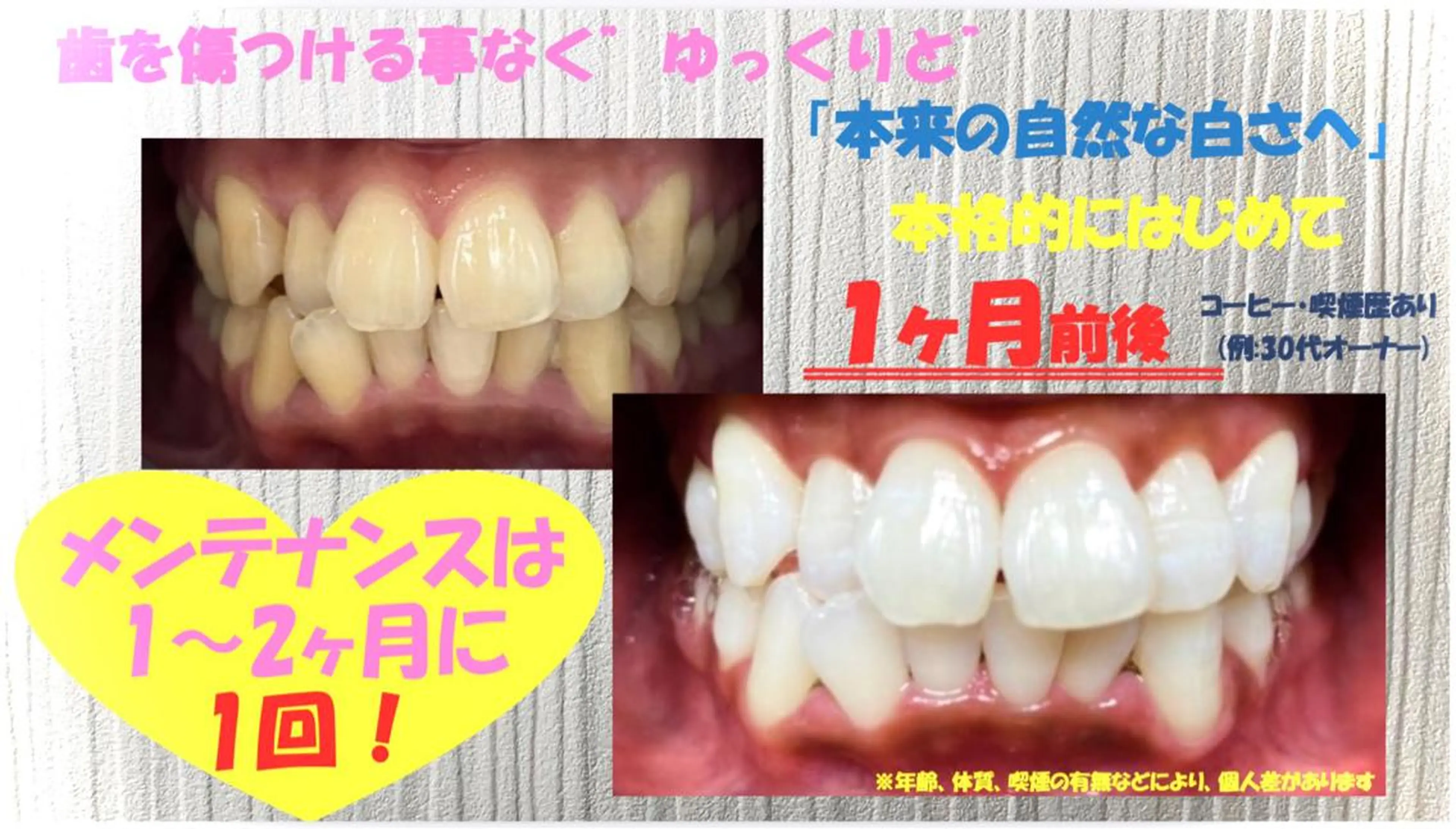 その他 セルフホワイトニングサロン　ラヴィアン所属・ホワイトニングサロン La vie enのその他イメージ