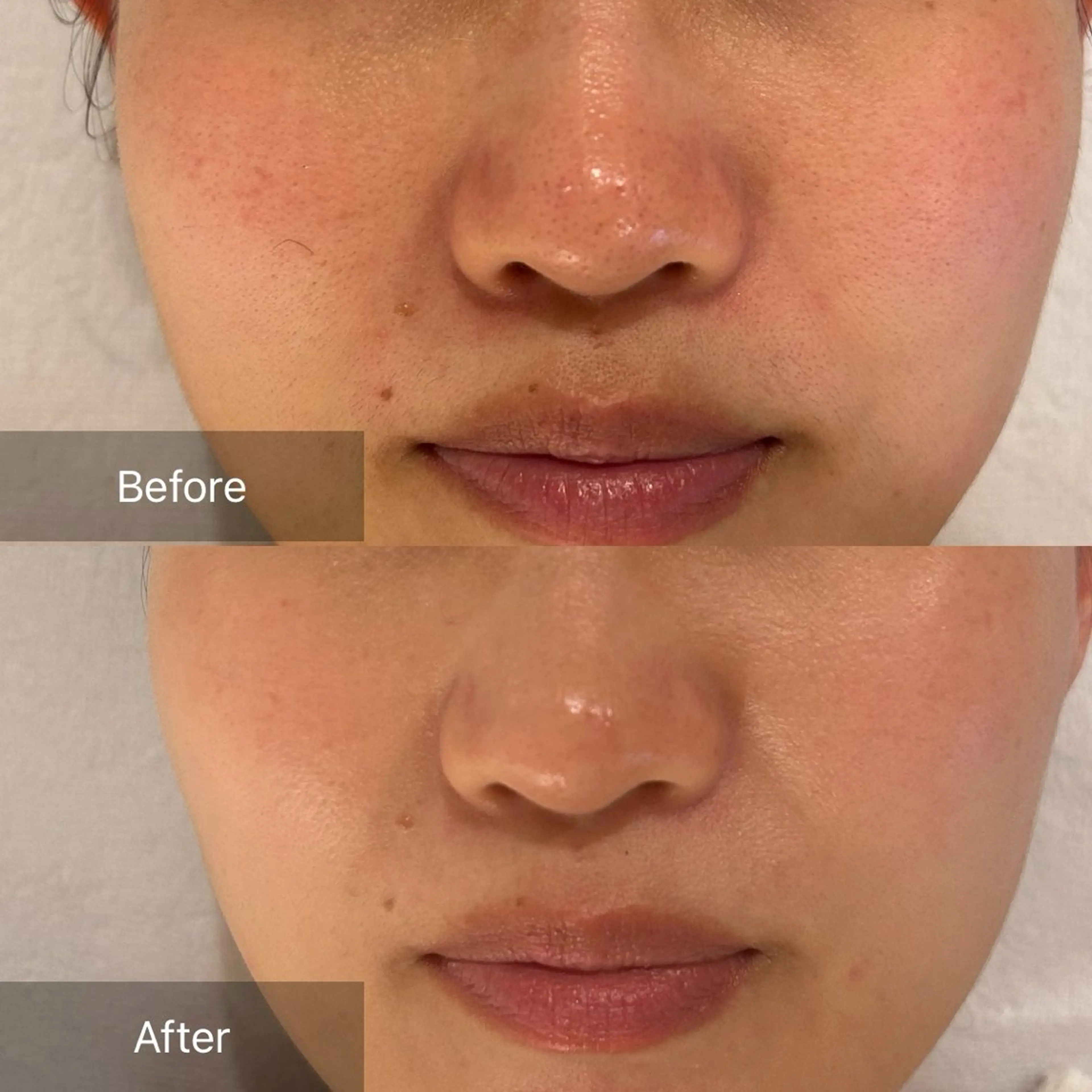 mine.mi マインエムのエステ・リラクイメージ