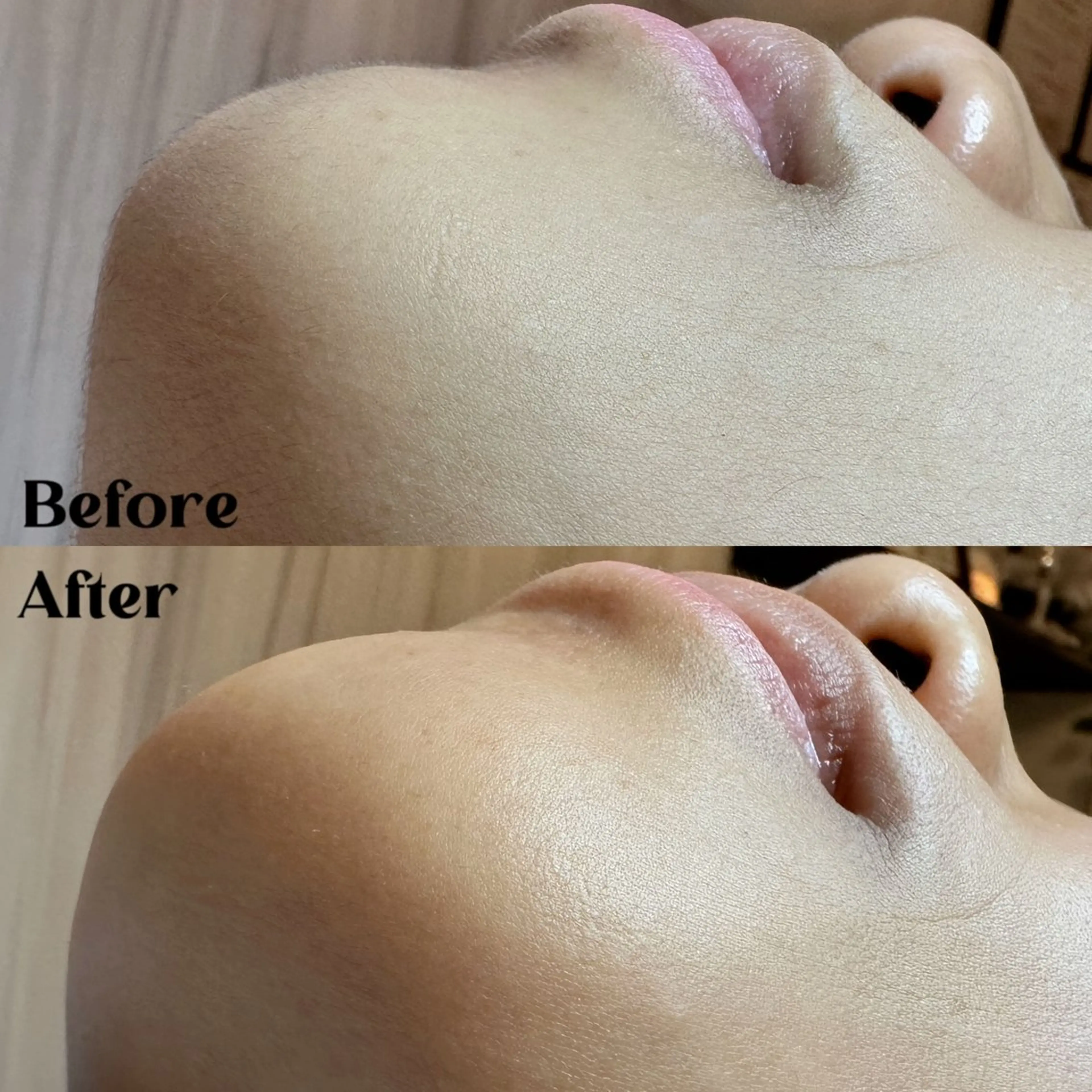 Hitomi シュガーリング豊橋のその他イメージ