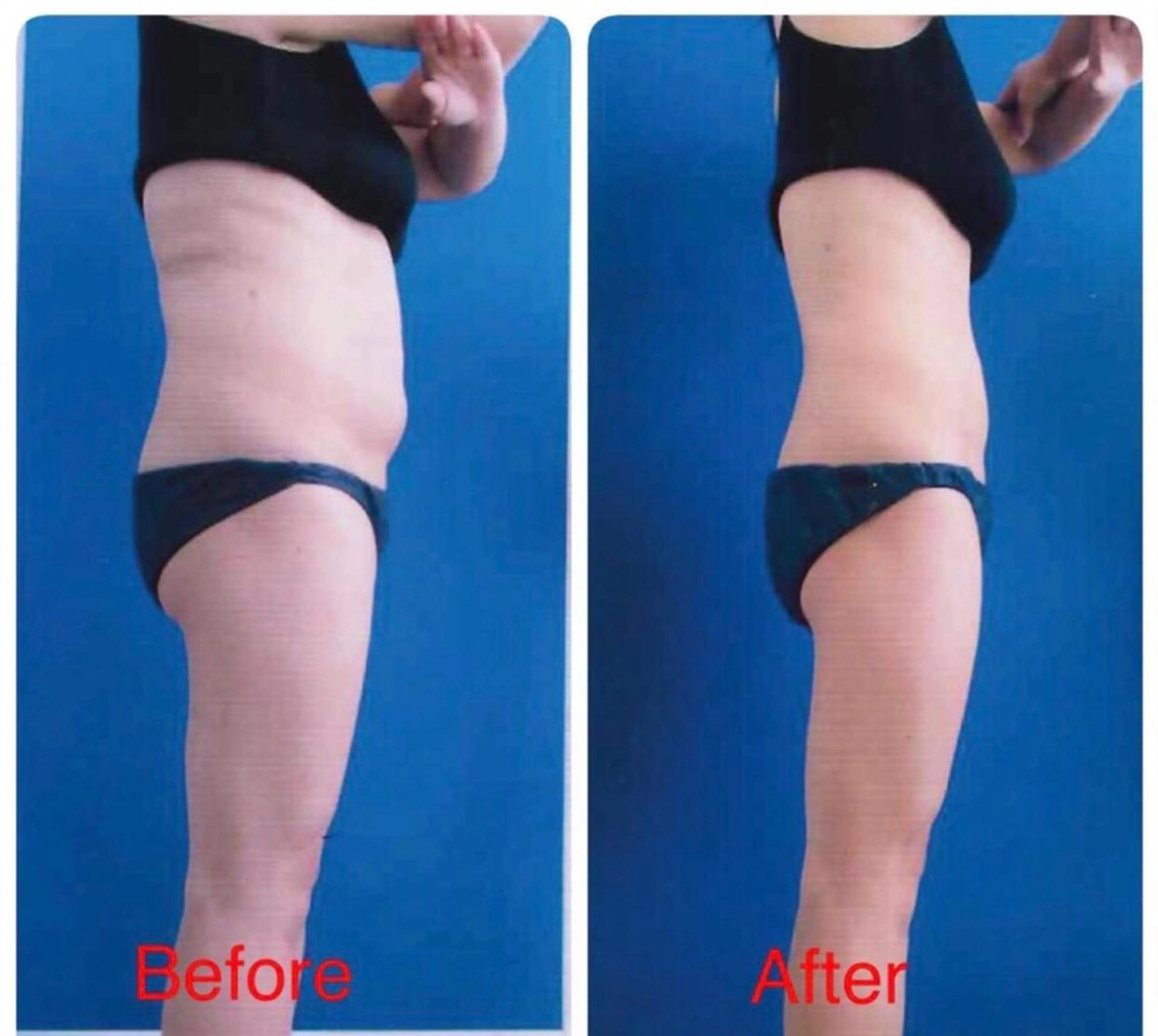 エステ 全身痩身✨ キレイサローネ表参道のエステ・リラクイメージ