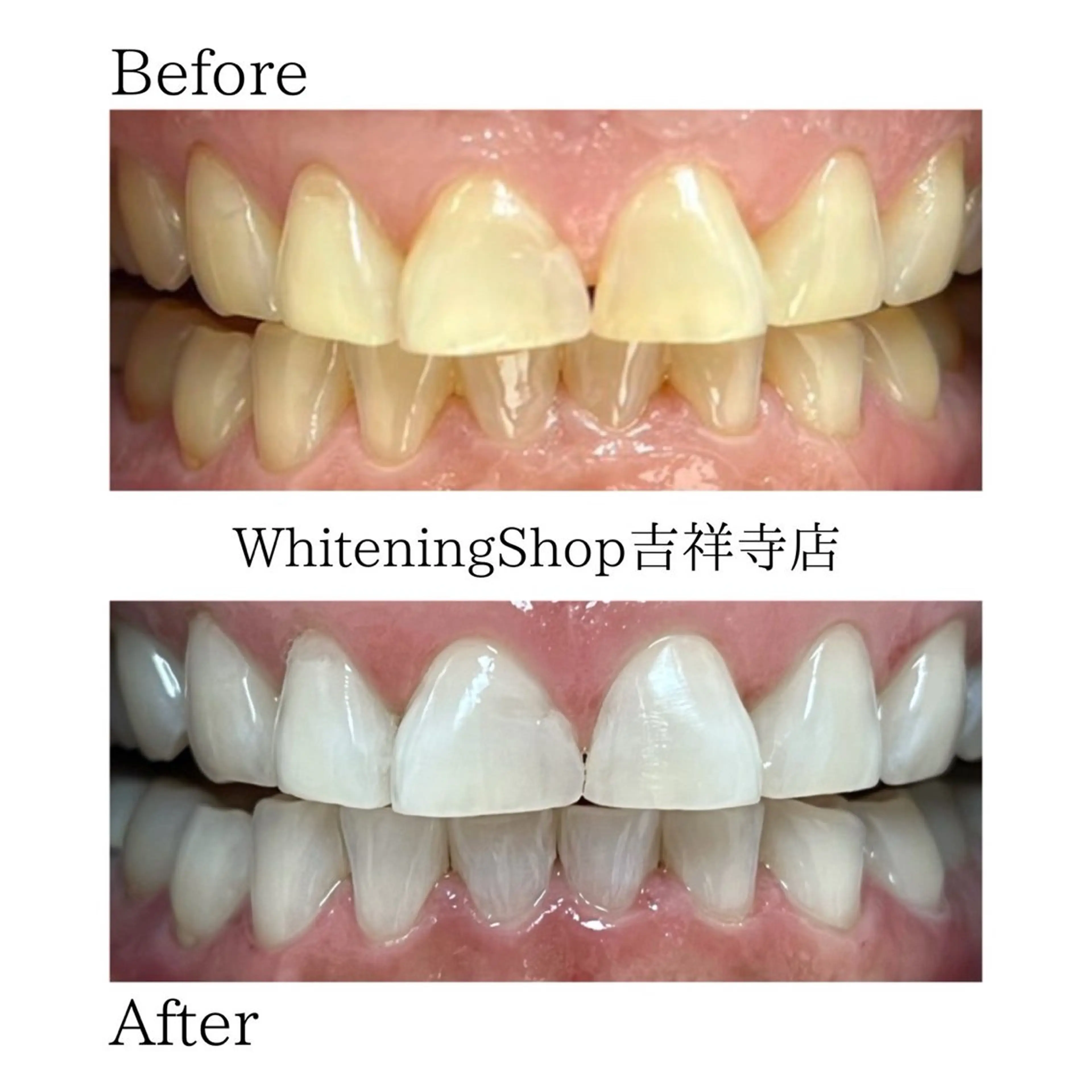 エステ リラク ホワイトニング ショップ吉祥寺店のエステ・リラクイメージ