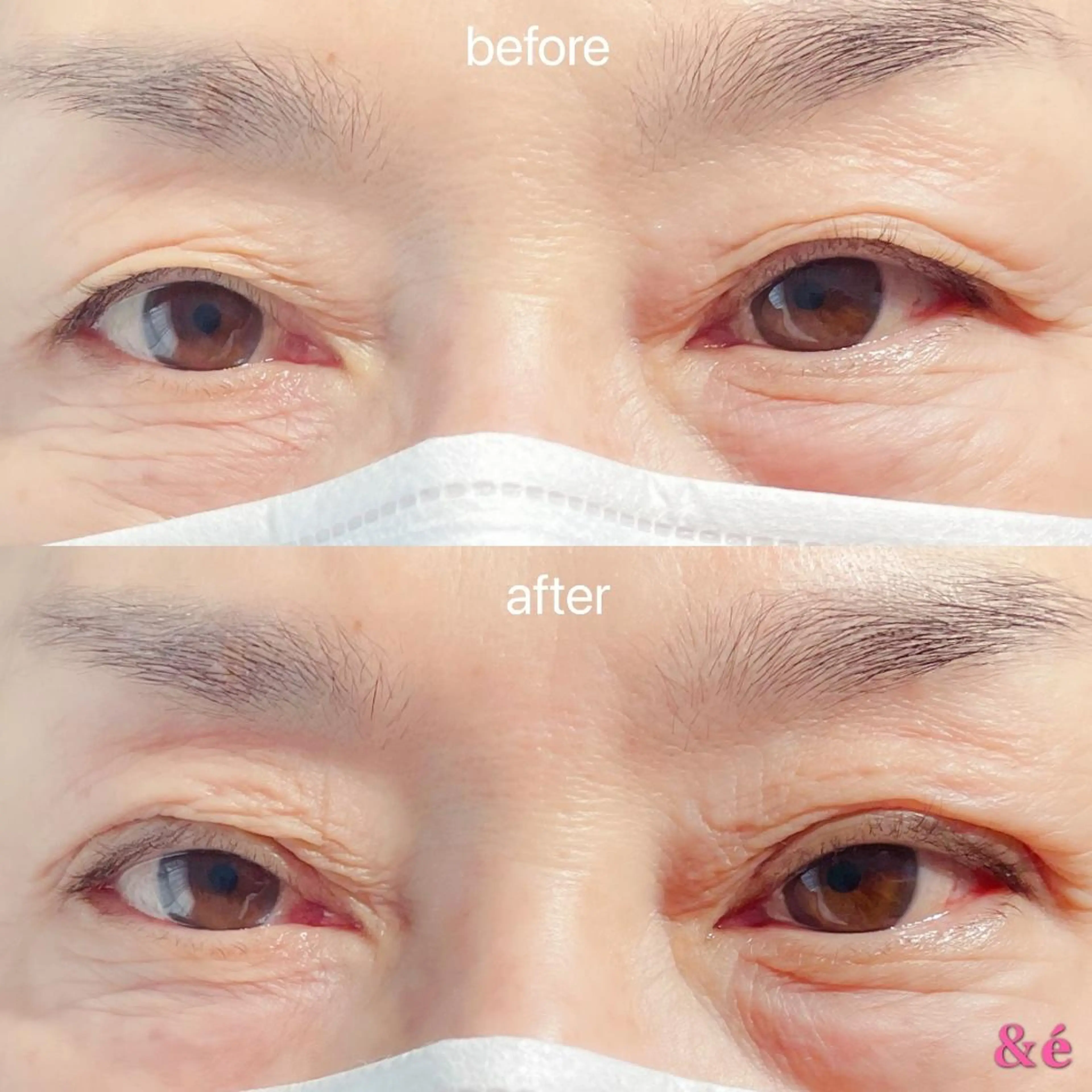 マツエク・マツパ マツパ 【＆é アンドイー】 河本絵美のマツエク・マツパデザイン