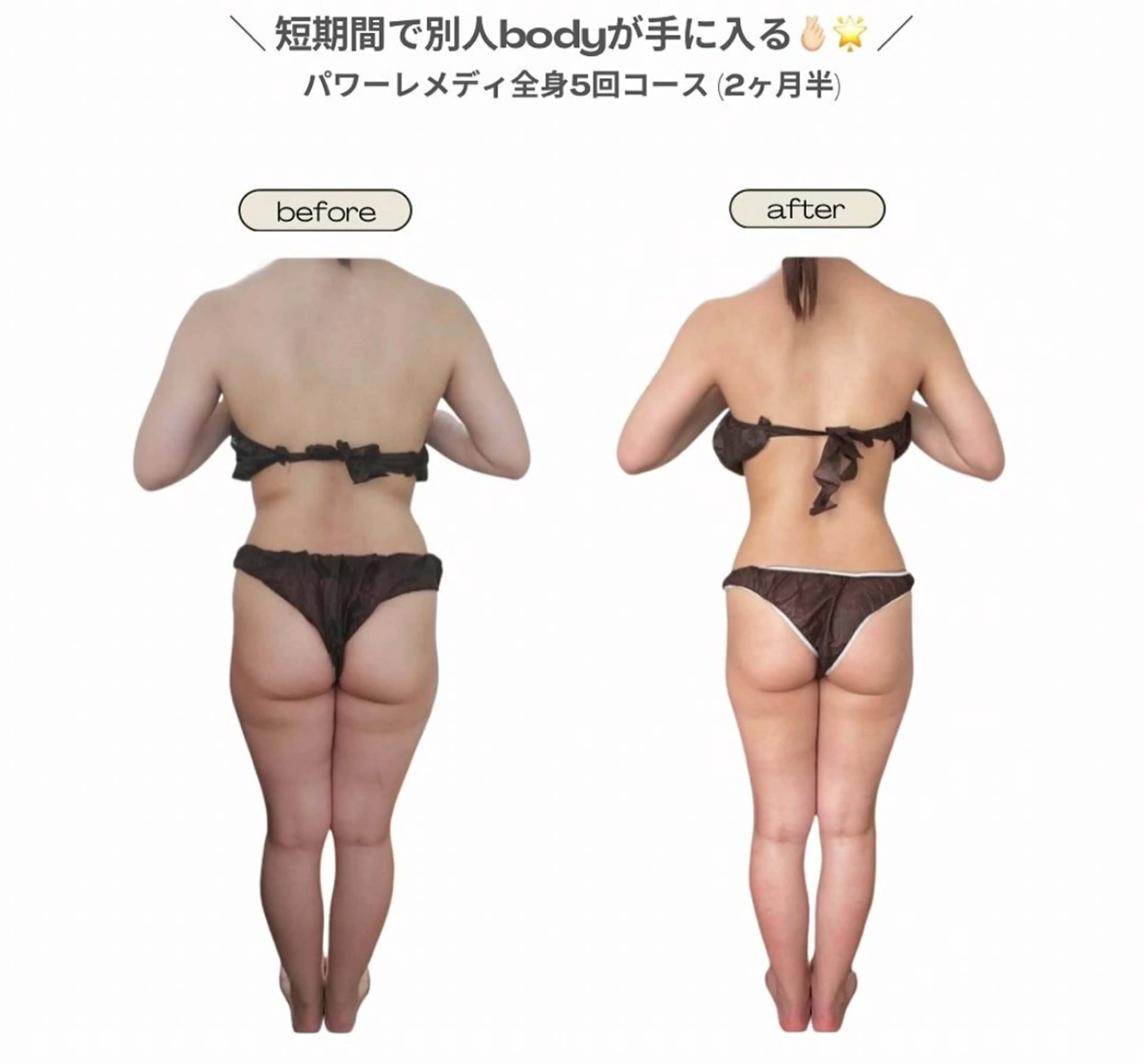 エステ リラク 《本気痩せ×疲労改善 》  BILOOPのエステ・リラクイメージ