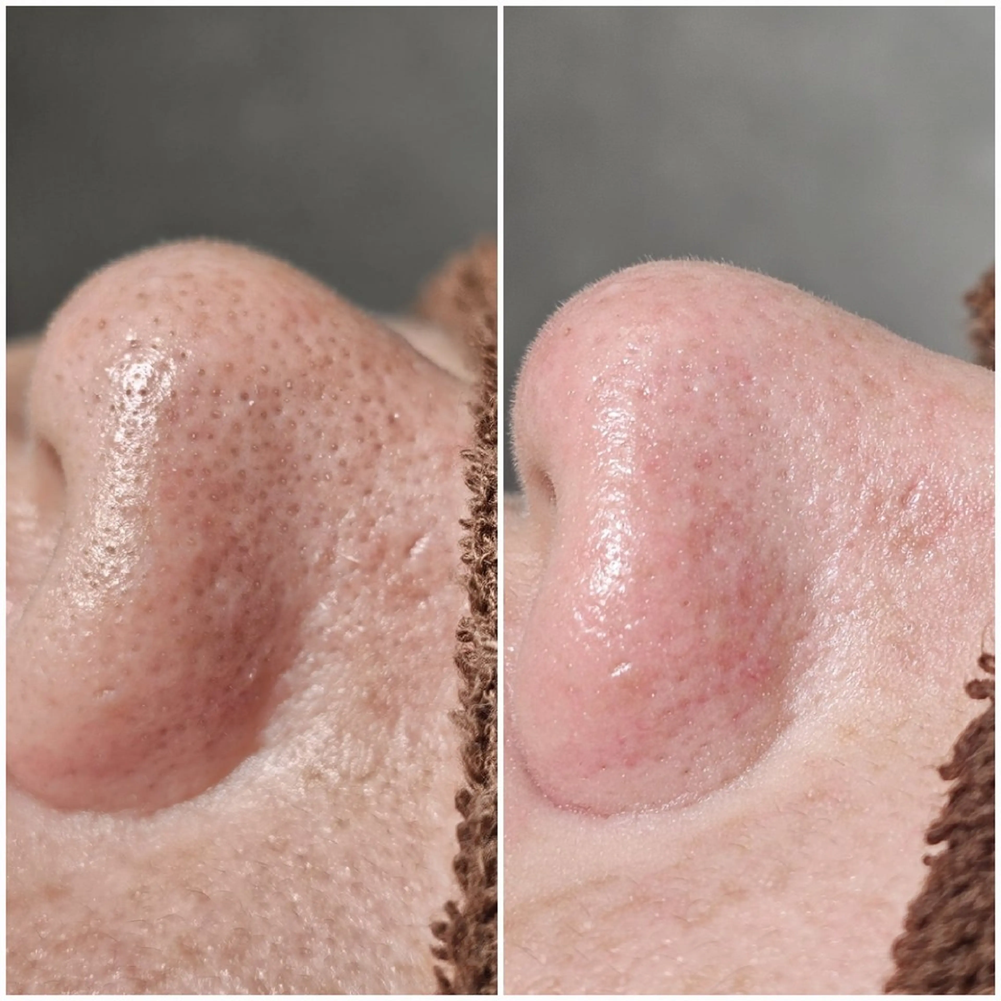 エステ Iryアイリー所属・Iry アイリーのエステ・リラクイメージ