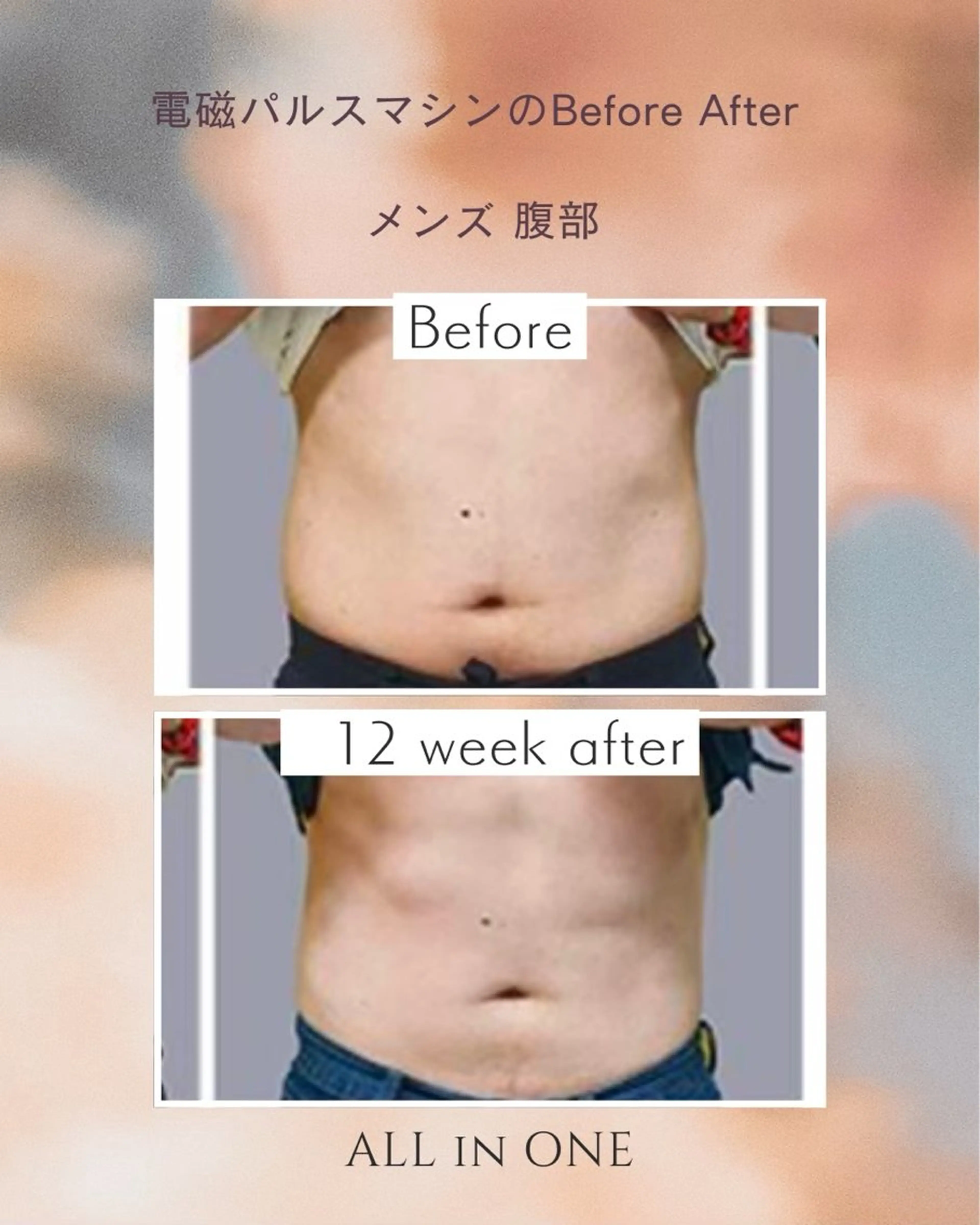 メンズ エステ 1組貸切 セルフエステのエステ・リラクイメージ