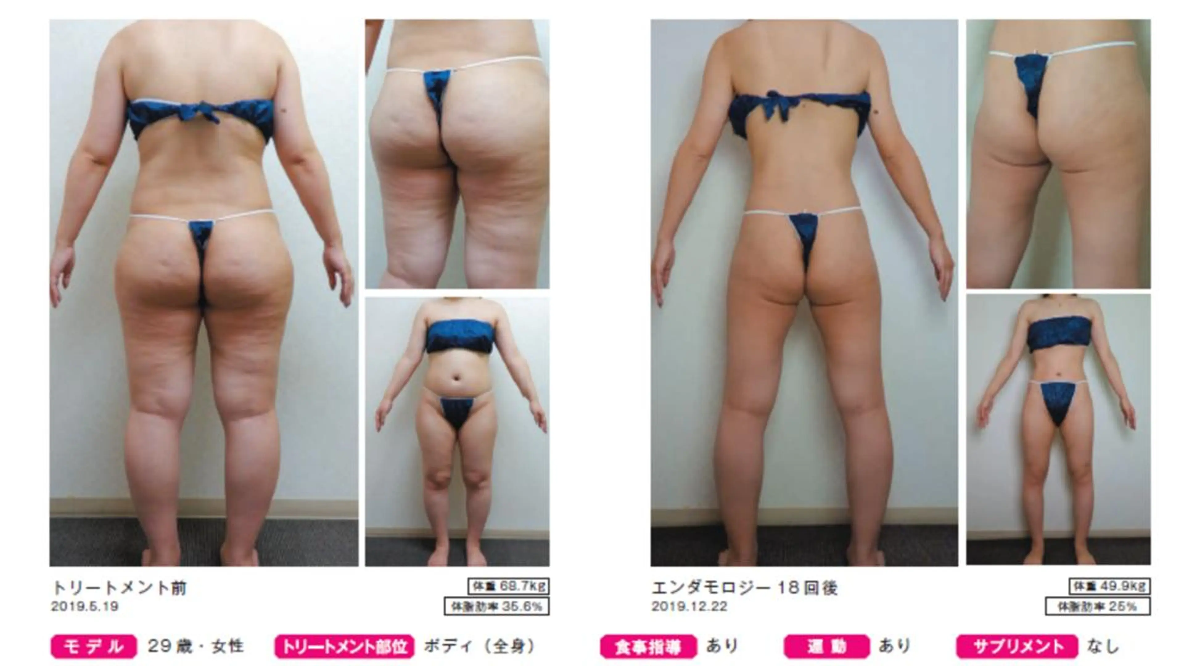 オレンジバナナ 県央店のエステ・リラクイメージ