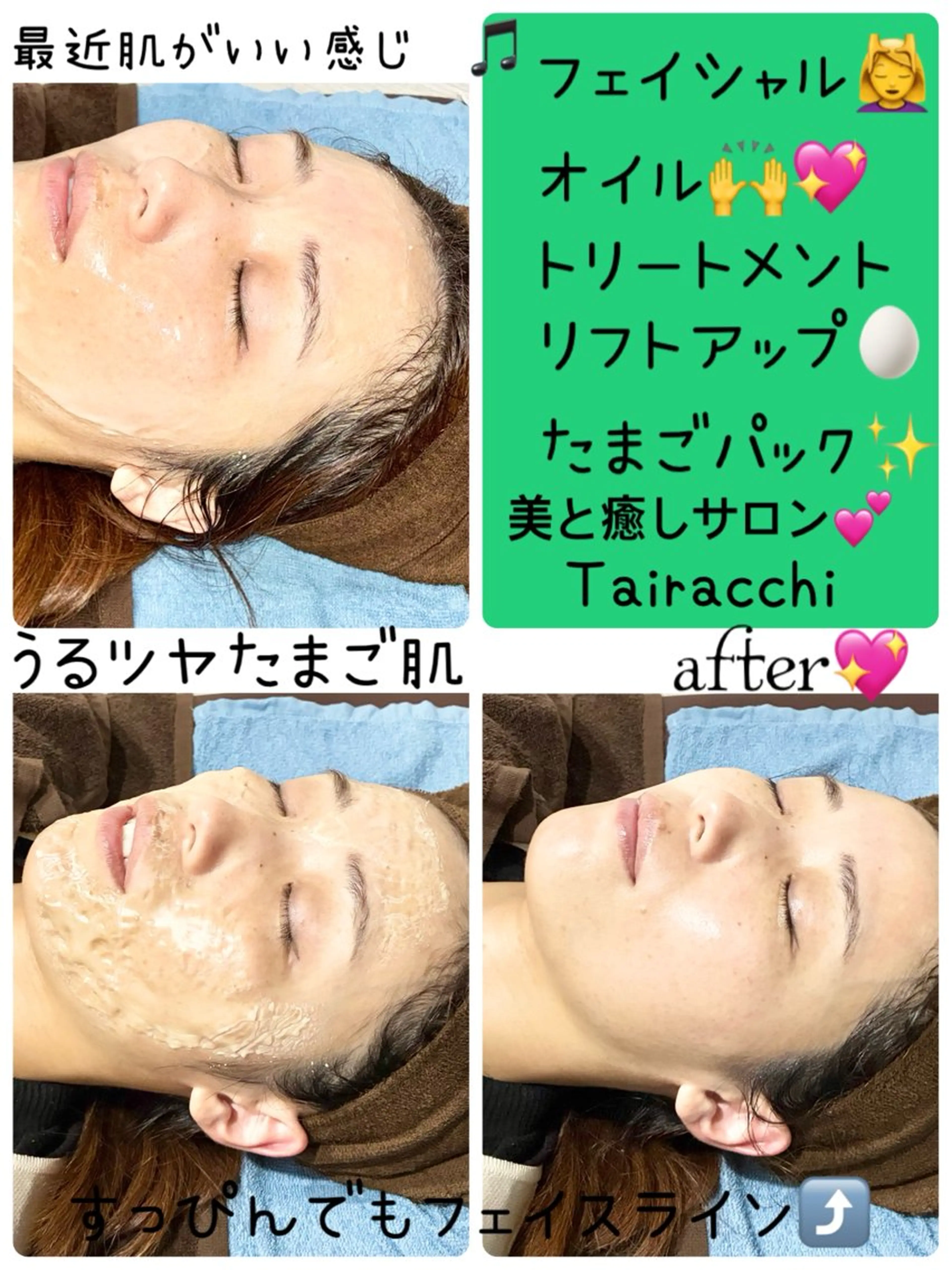 エステ Tairacchi タイラッチのネイルデザイン