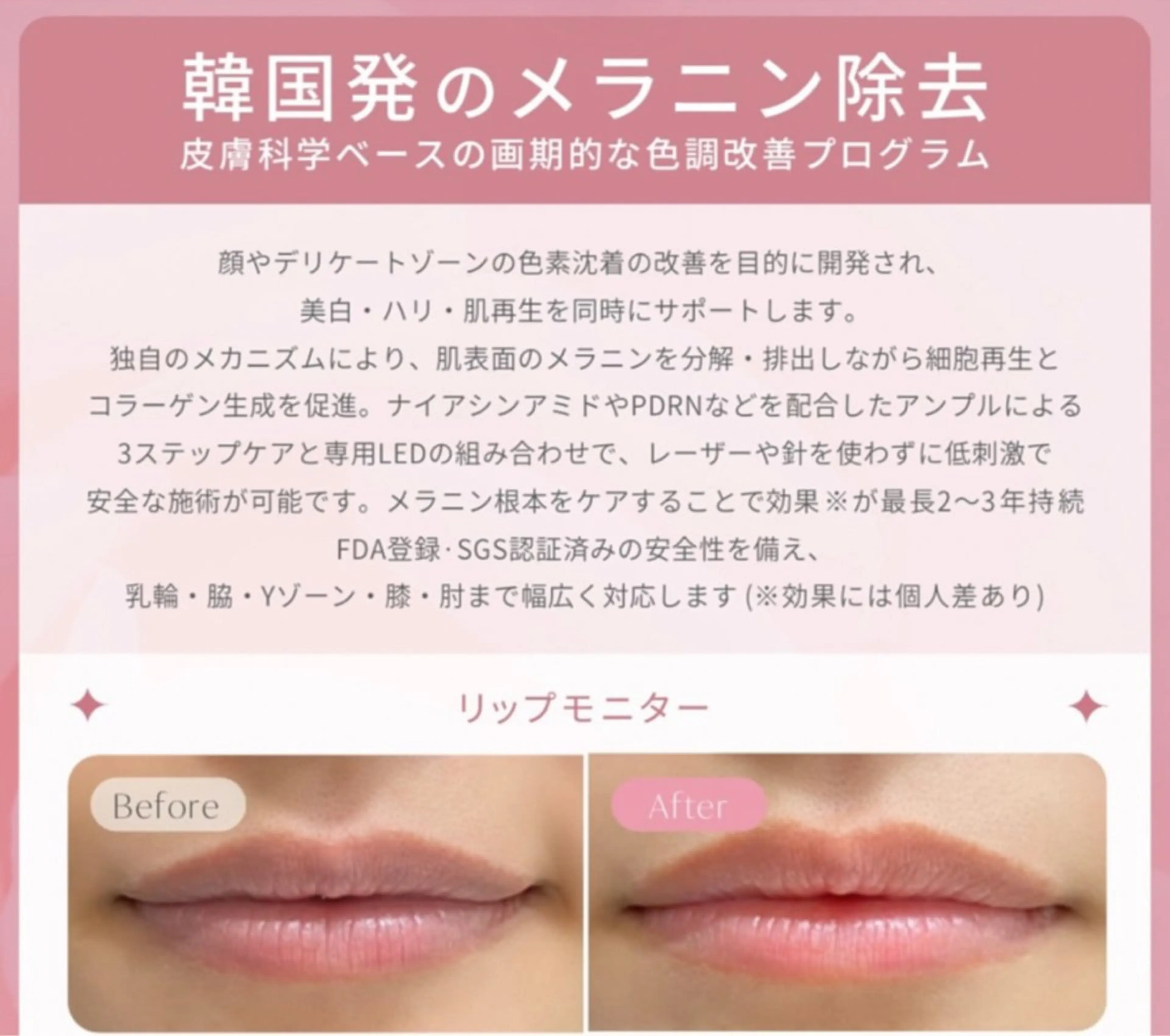 KIRAN 山﨑のエステ・リラクイメージ