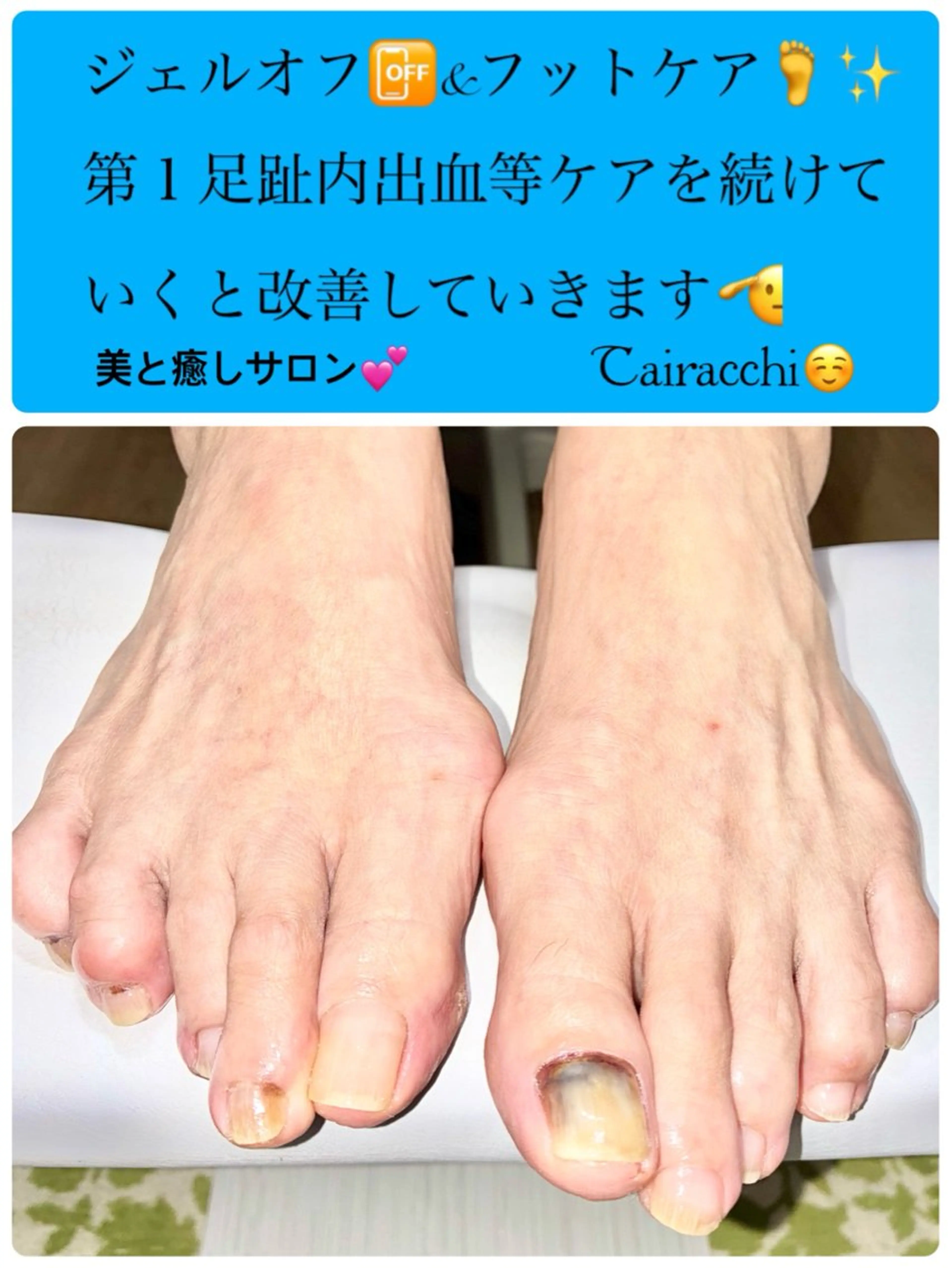 ネイル フットネイル フットネイル Tairacchi ﾀｲﾗｯﾁのエステ・リラクイメージ