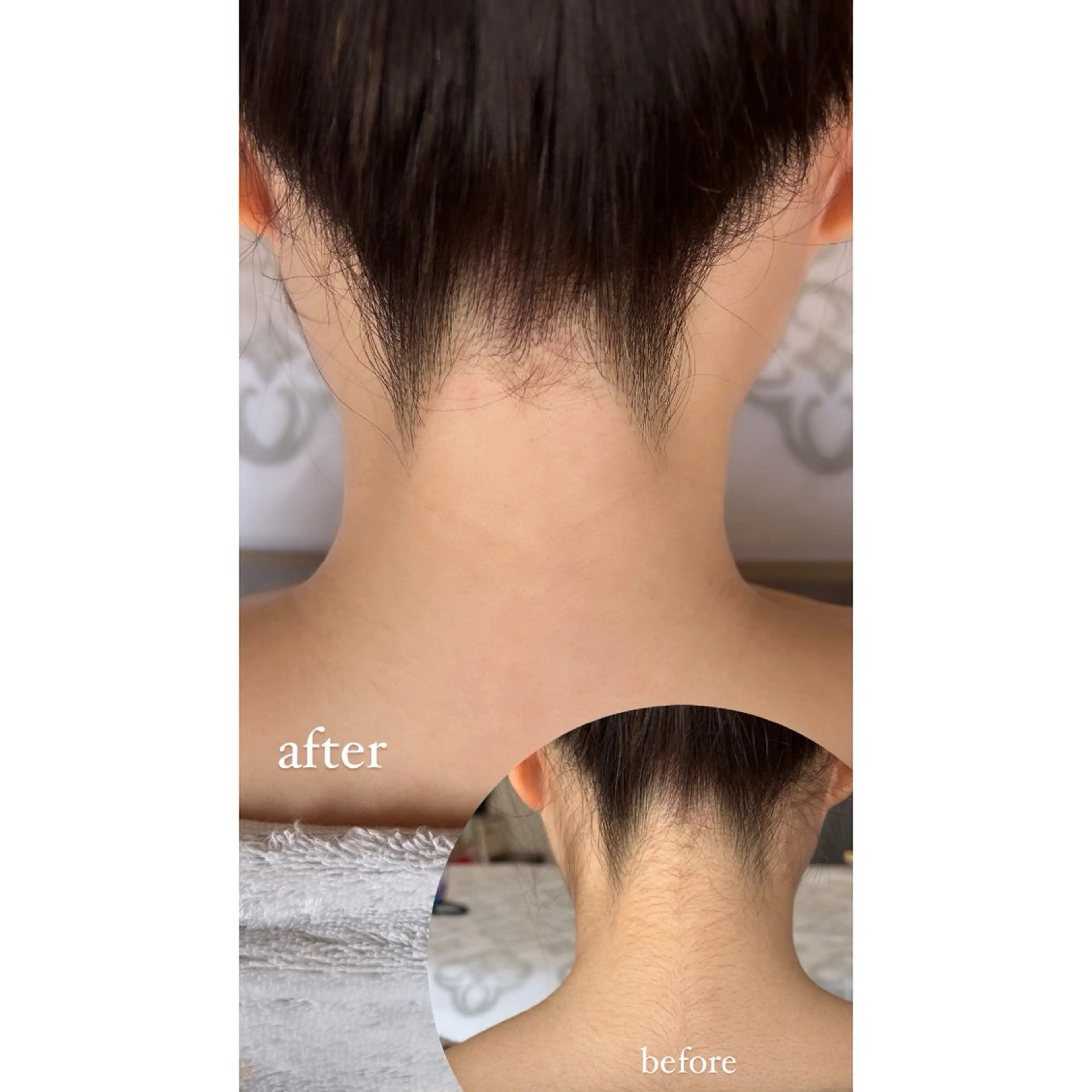 ワックス脱毛🌈 ESPOIRnocoのエステ・リラクイメージ