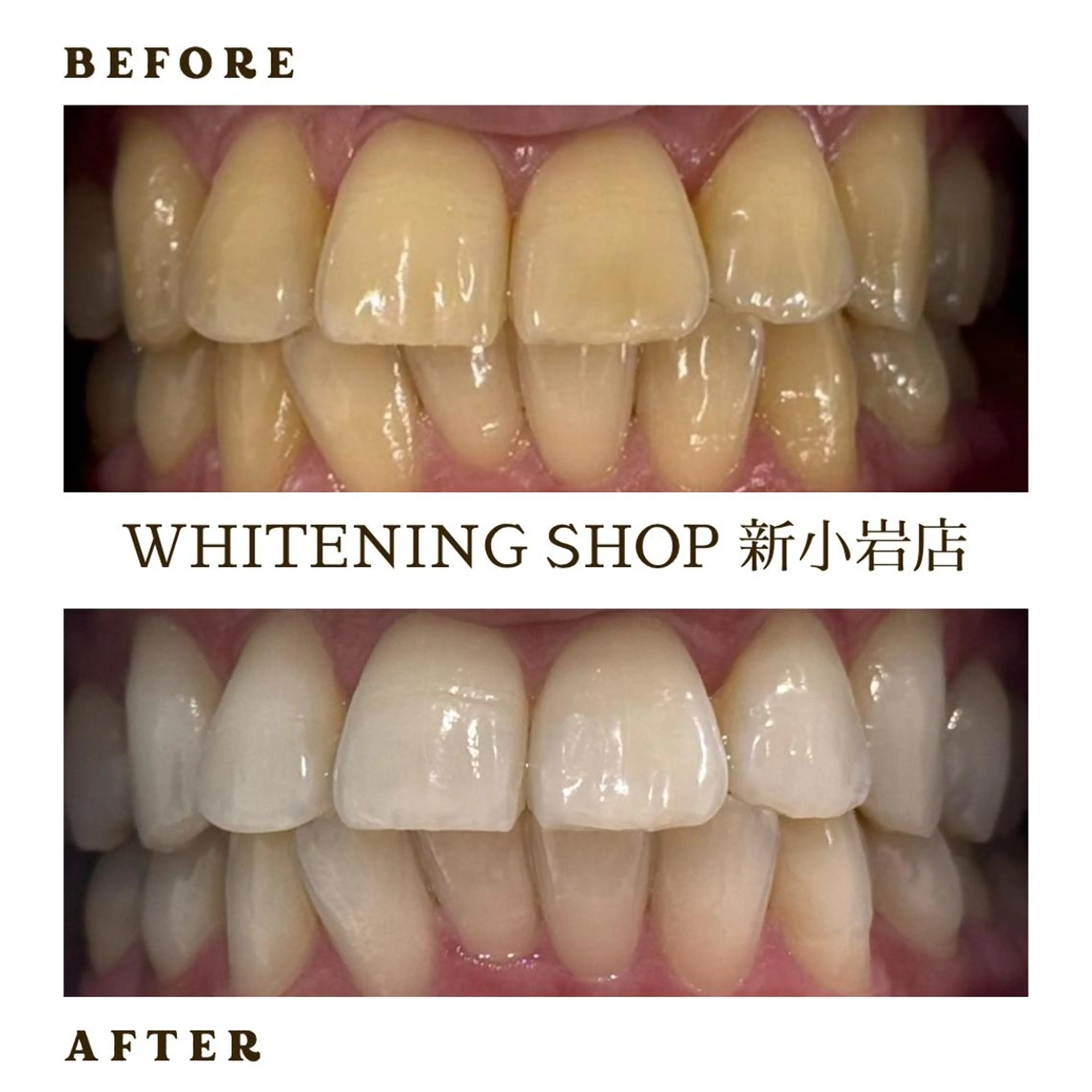 メンズ その他 ホワイトニング ショップ新小岩店のその他イメージ