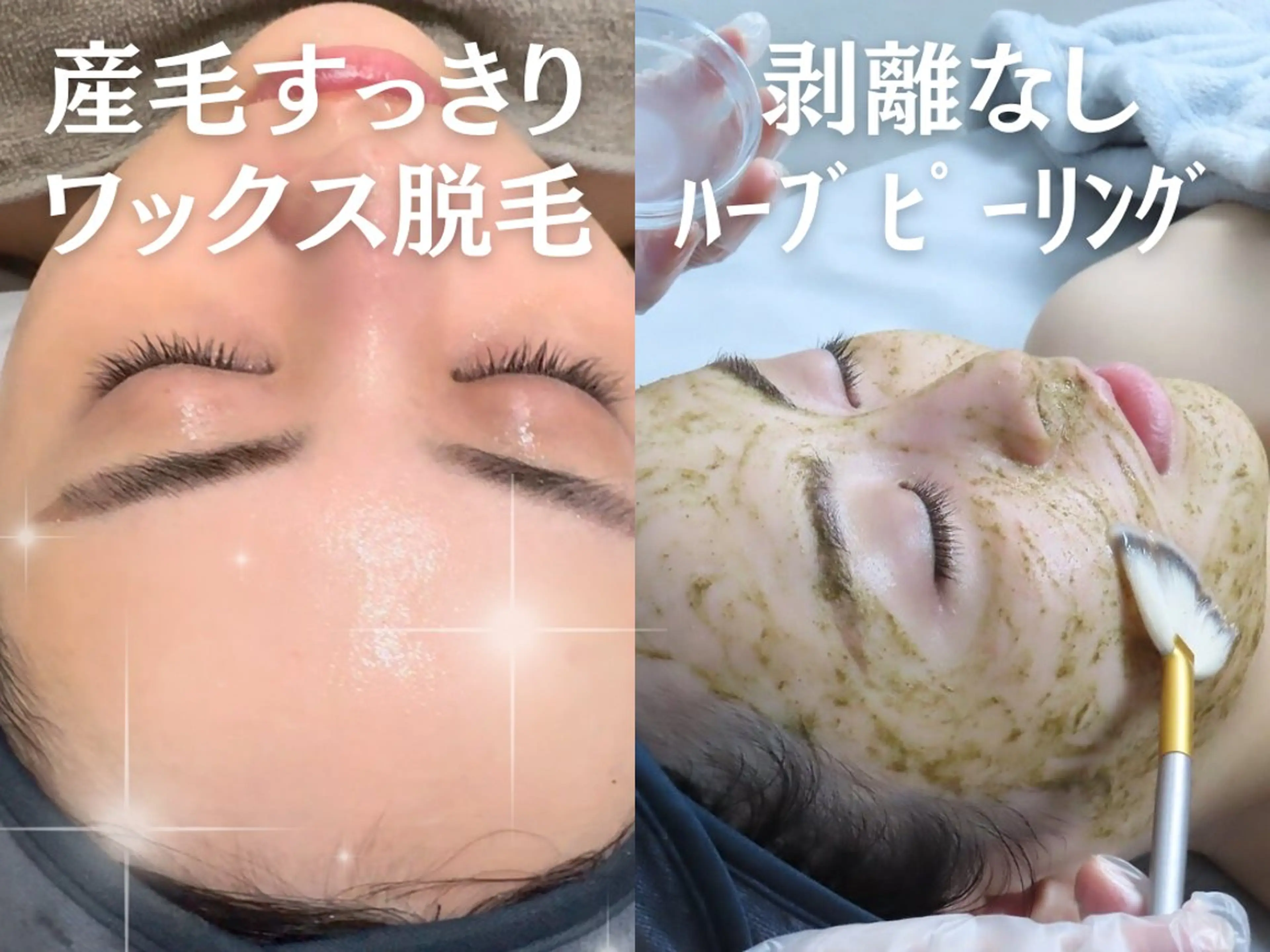 毛穴&ニキビ専門 Bonita Ange恵比寿所属・ハーブピーリング 渋谷恵比寿のエステ・リラクイメージ