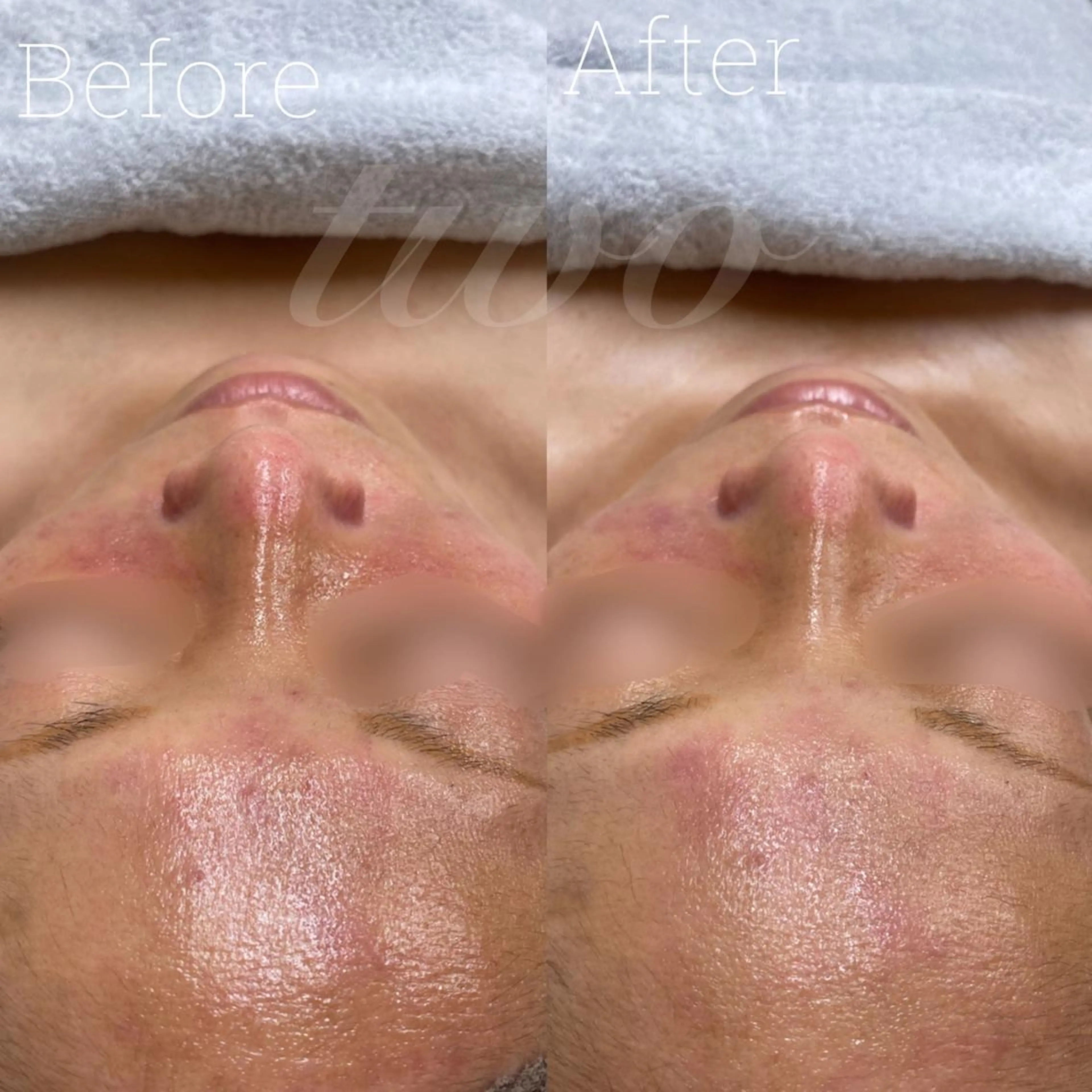 エステ 《心斎橋》 twoのエステ・リラクイメージ