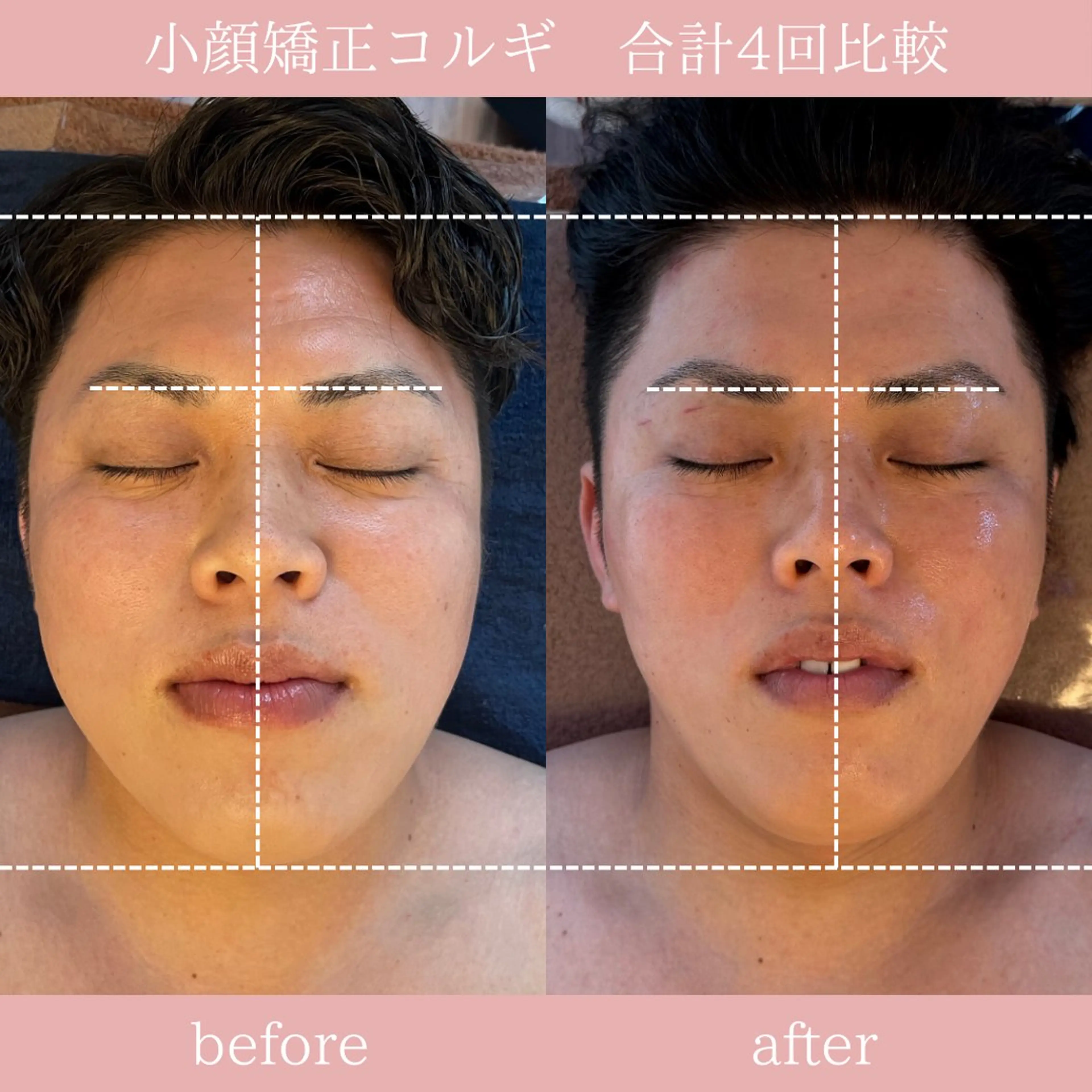 エステ 眉毛/小顔/ハーブ 🌼hikaruの眉毛・アイブロウイメージ