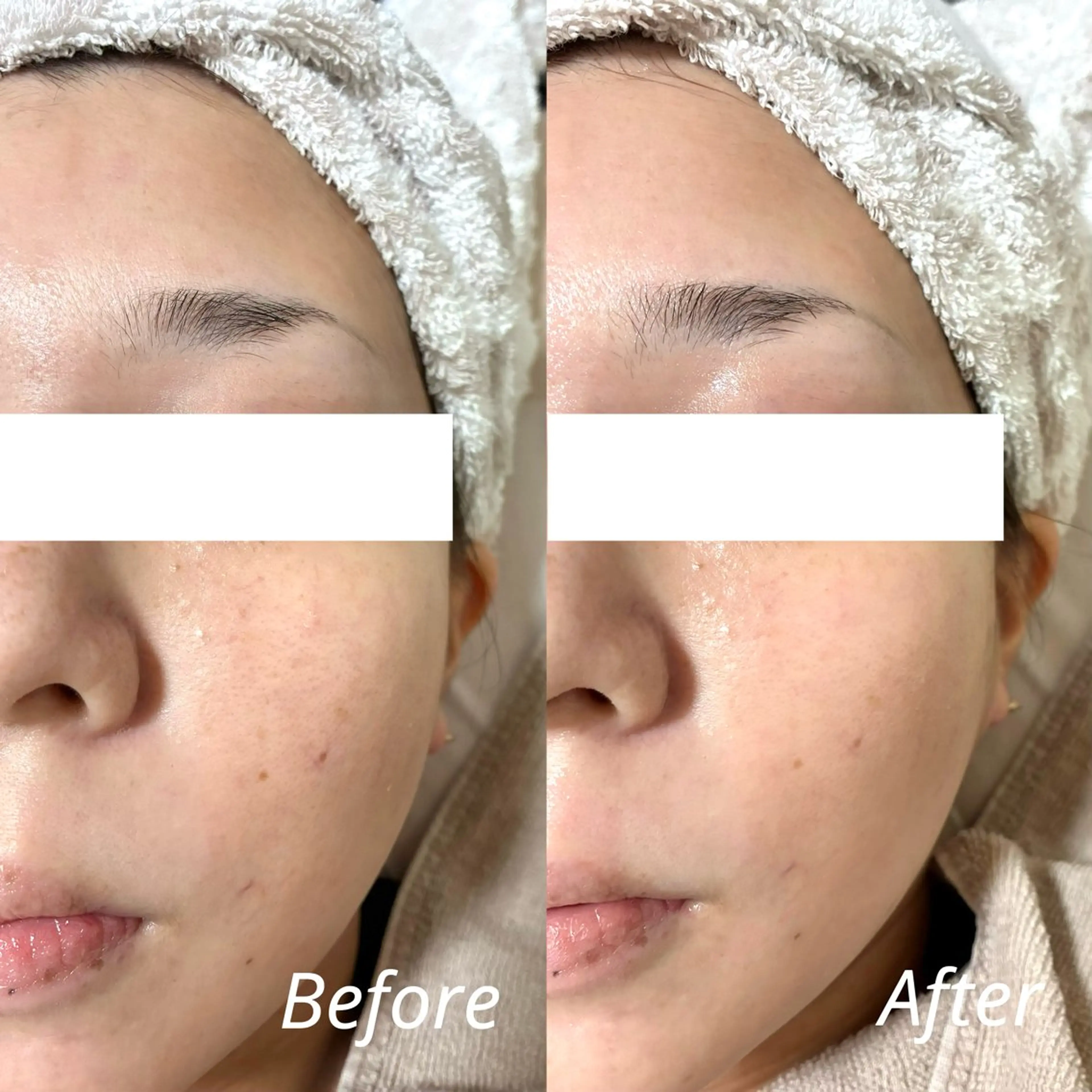 アイラッシュサロン リリィ🪷下山のエステ・リラクイメージ