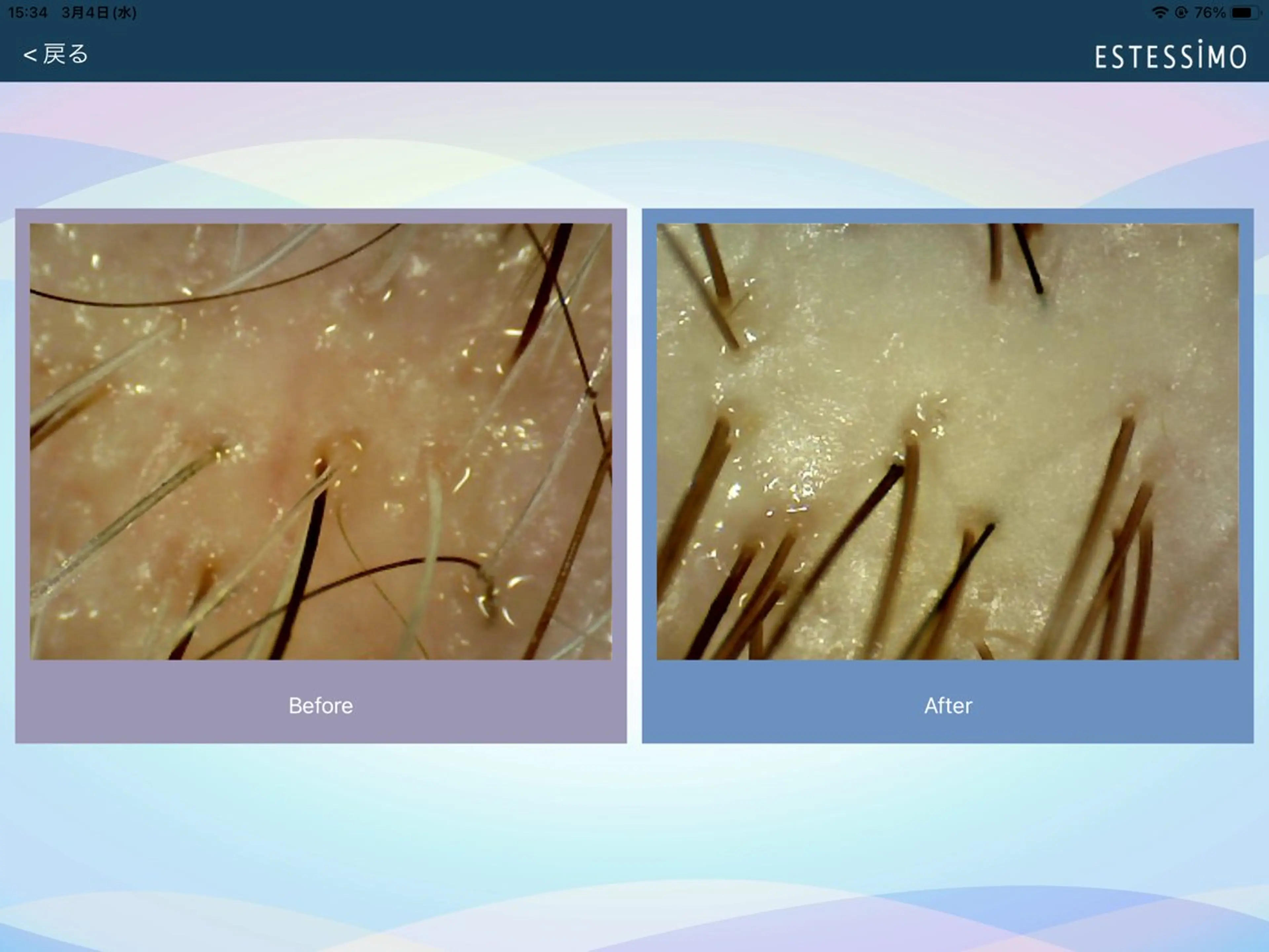 撮影モデル specials. 小室のその他イメージ