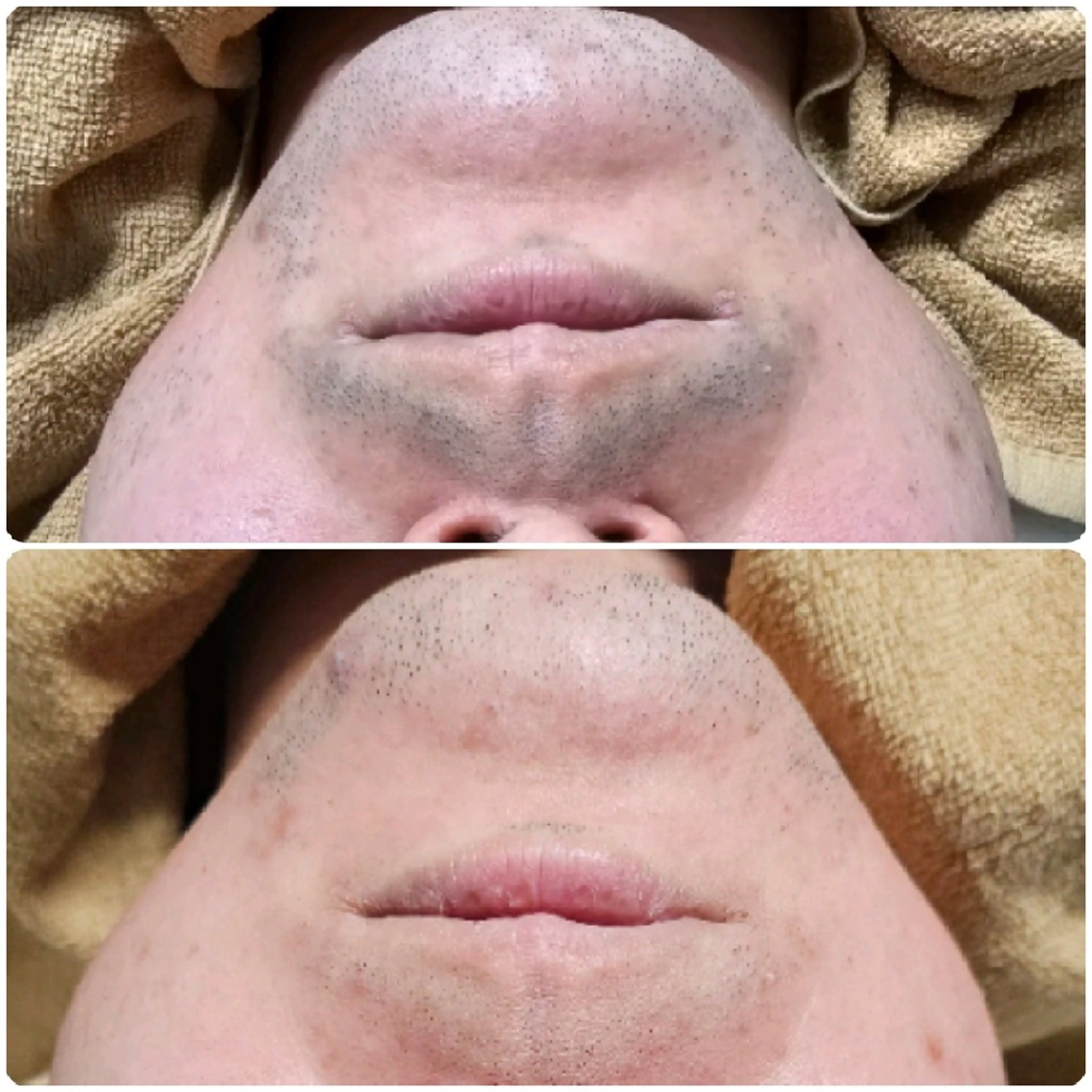 メンズ Iry アイリーのエステ・リラクイメージ