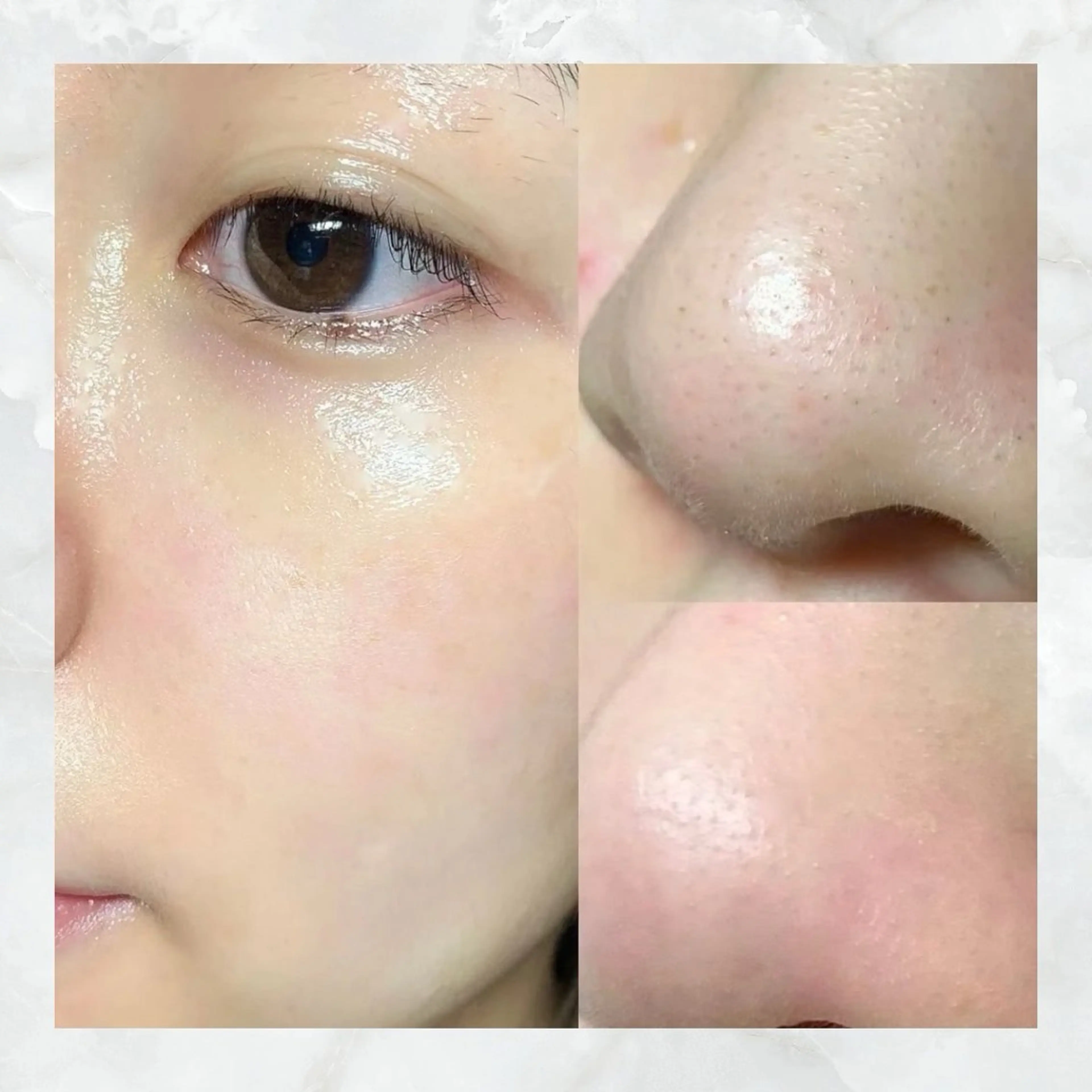 エステ リラク 愛維美水光美肌専門店所属・愛維美水光美肌専門店 メンズレディースokのエステ・リラクイメージ