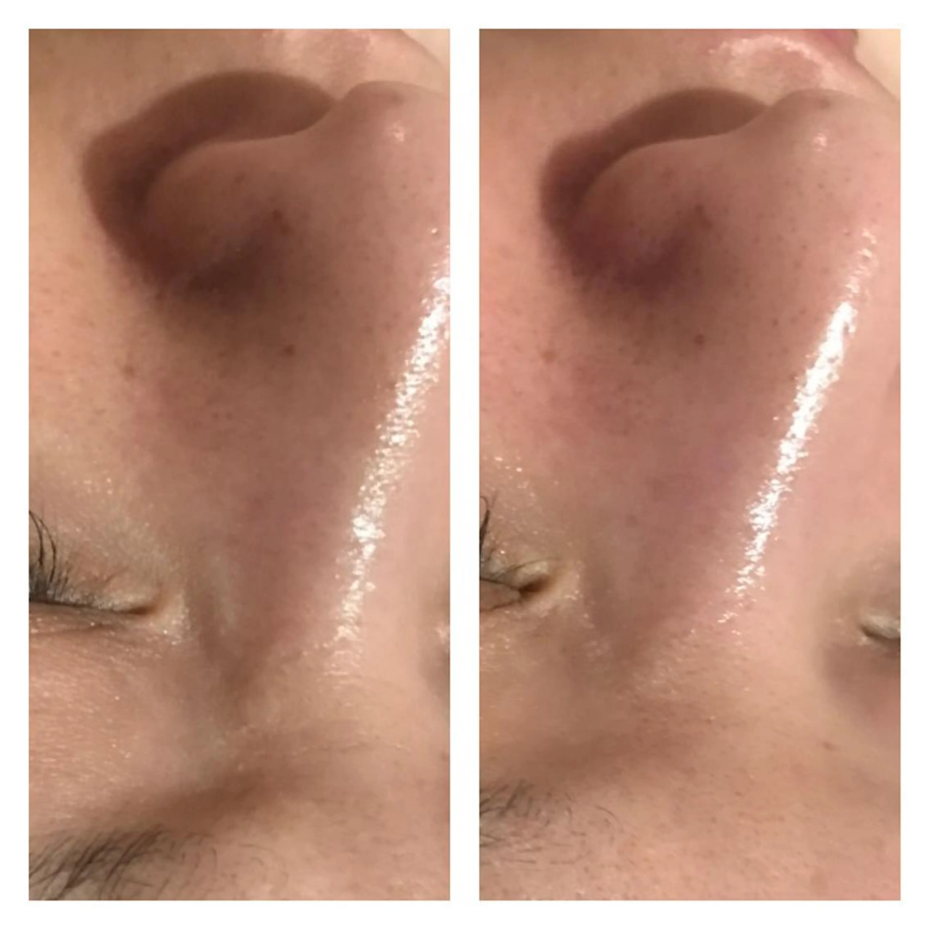 ネイル fairyrose organicエステのエステ・リラクイメージ