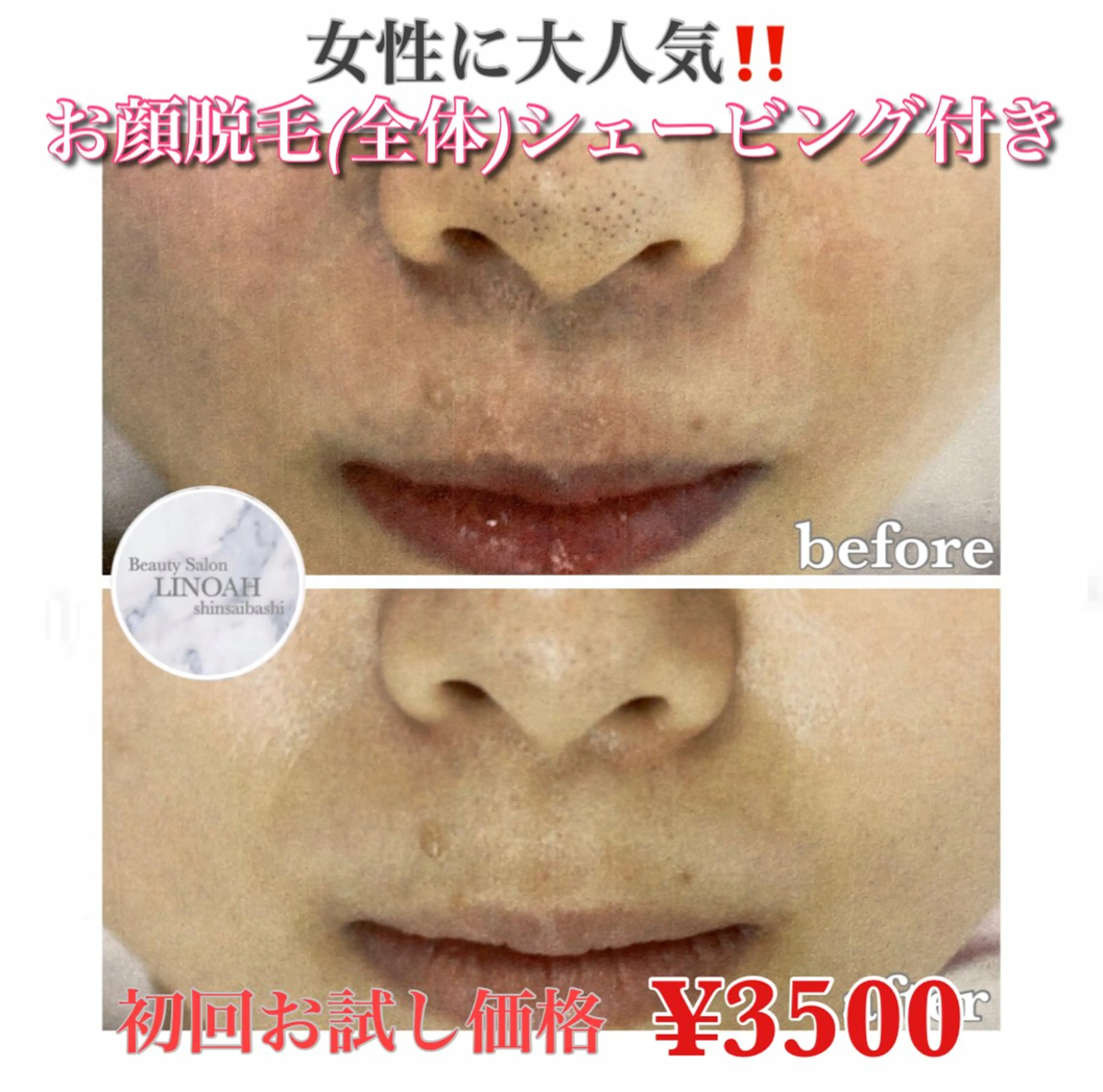 脱毛 ビューティーサロン リノア心斎橋店のエステ・リラクイメージ