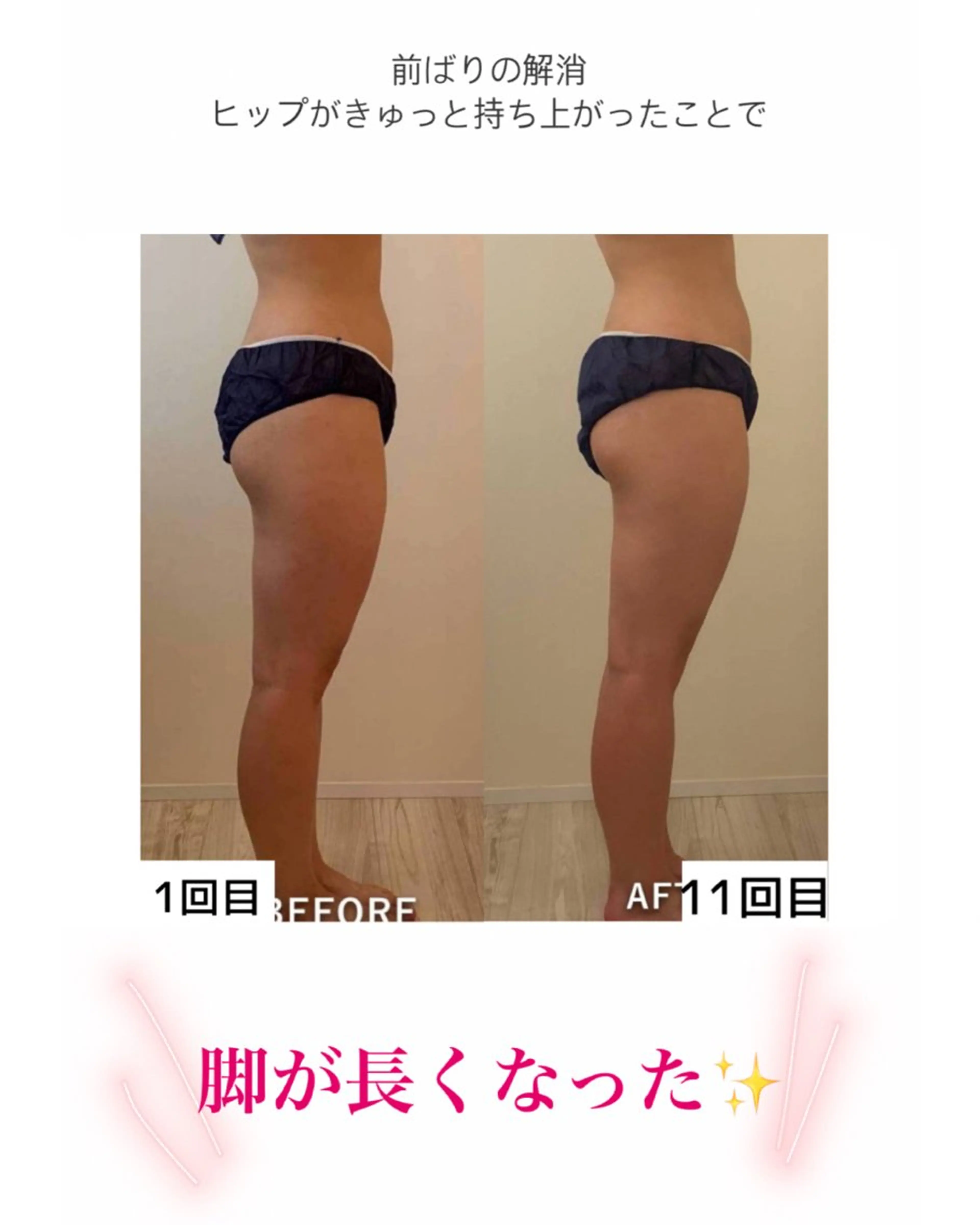 産後ダイエット−9㎏ Pourvous結衣のエステ・リラクイメージ