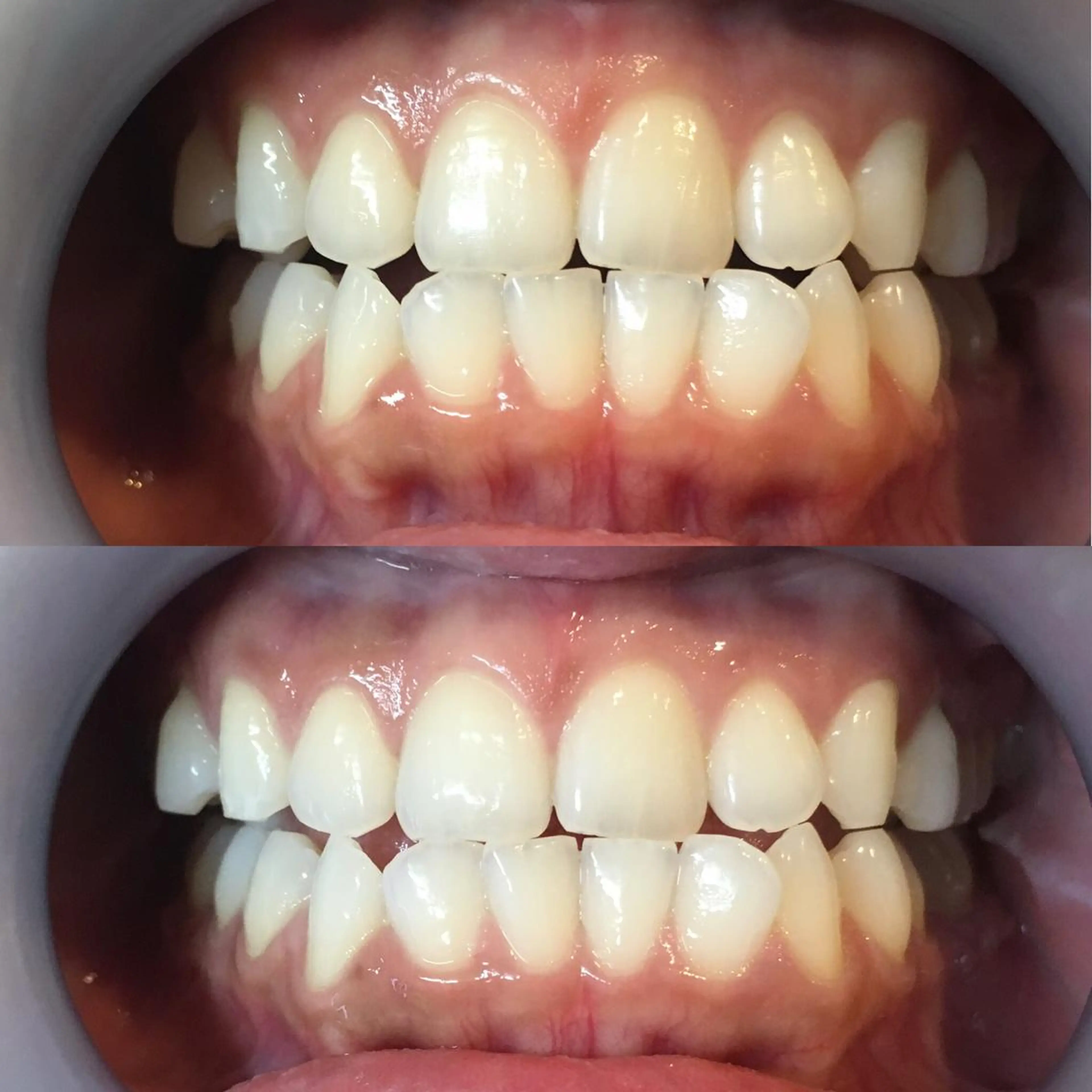 LBSホワイトニング 新宿店💎店長のエステ・リラクイメージ