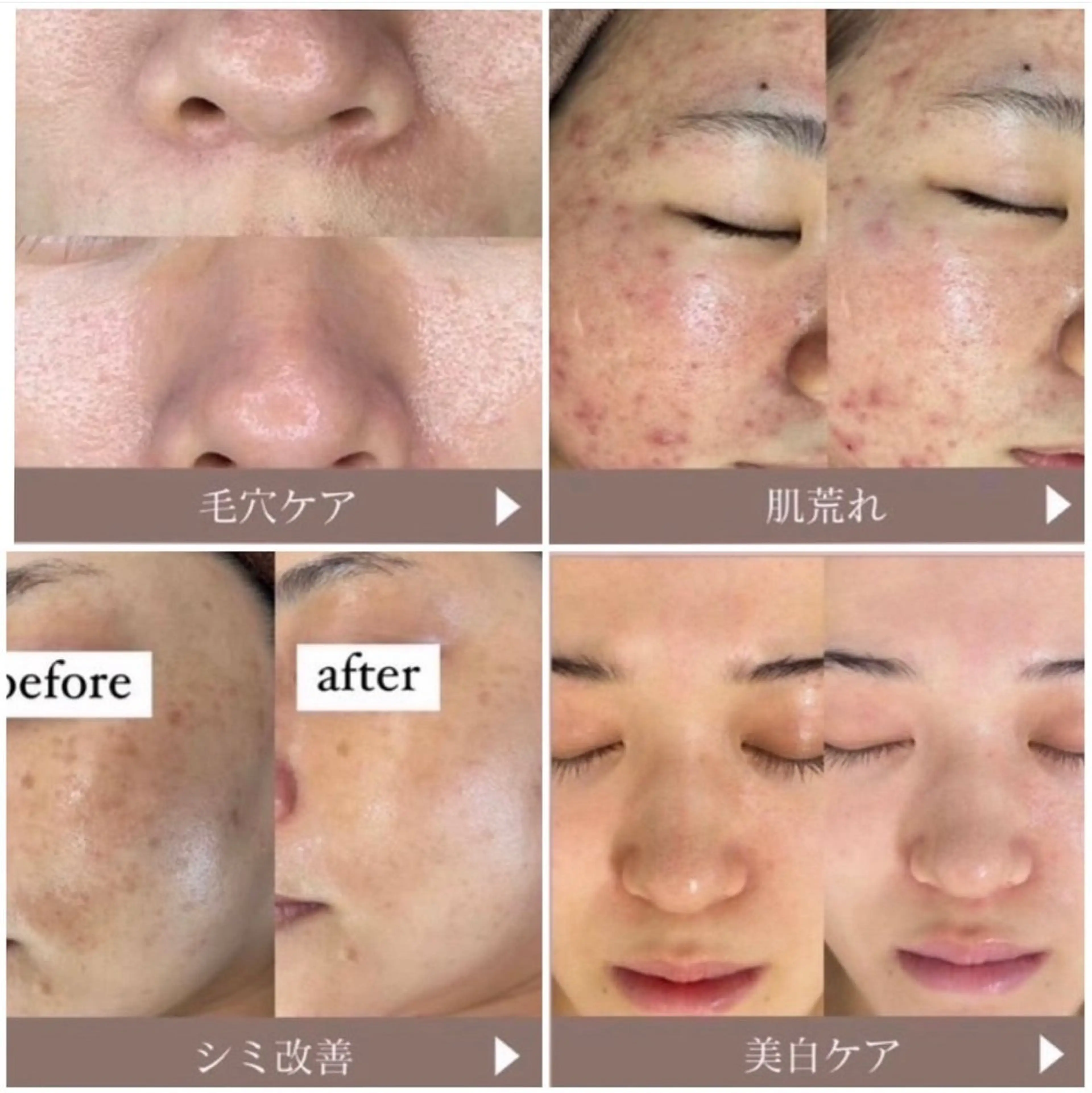 エステ WHITE AQUA 🌼柏店のエステ・リラクイメージ