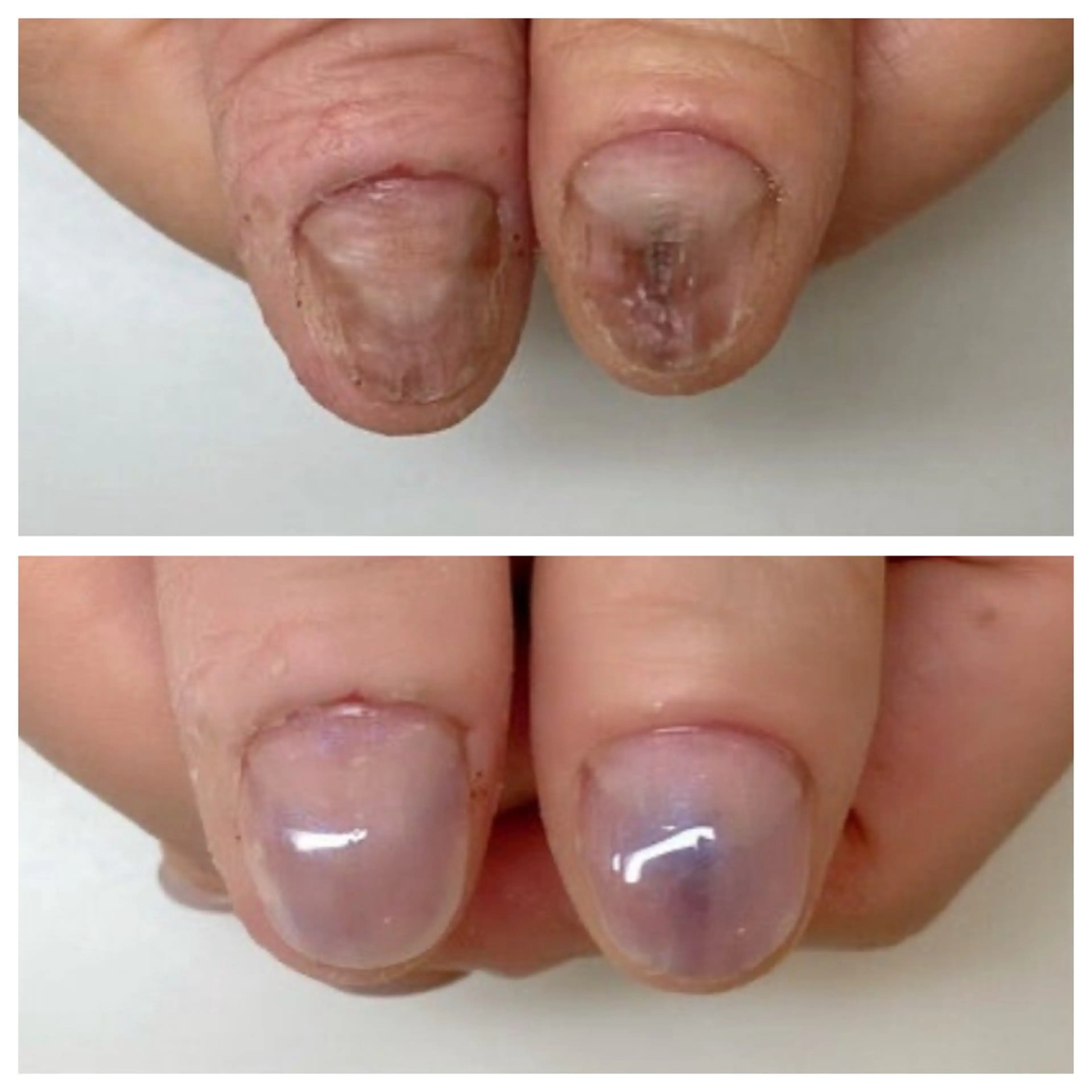 ネイル ネイルサロン アリュームのネイルデザイン