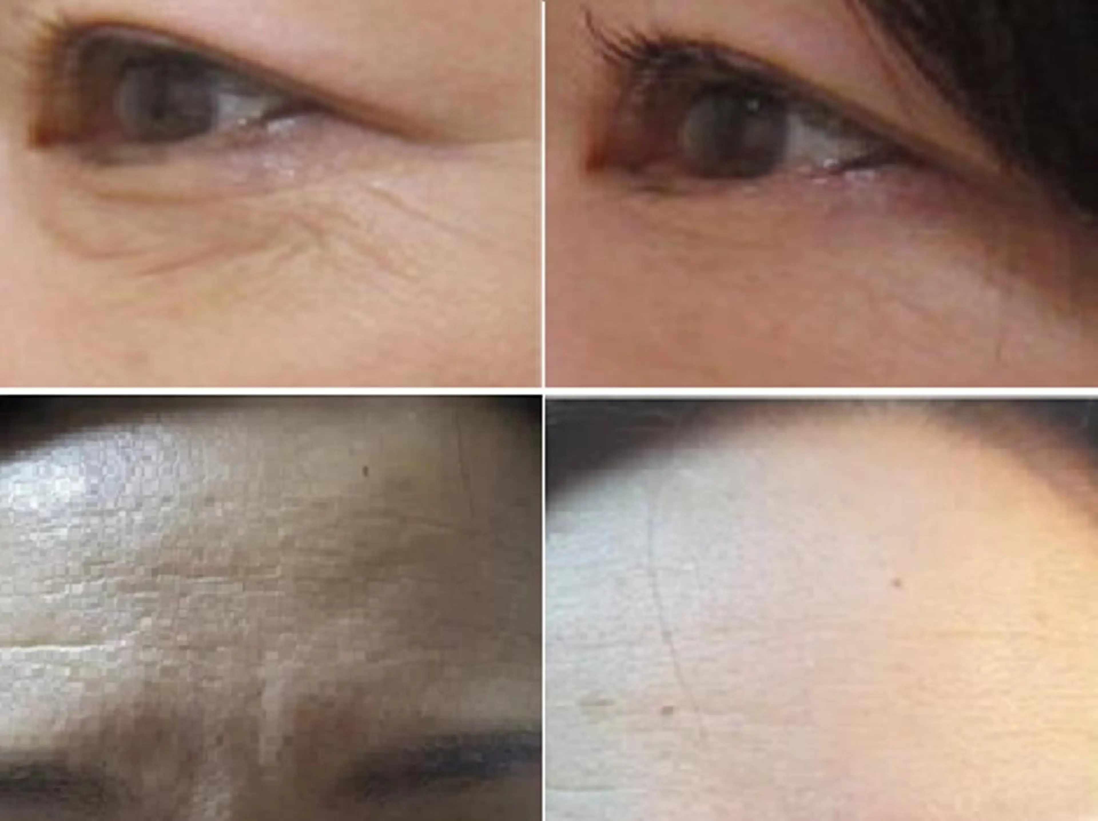 【小じわ集中ケア】Ｗフェイシャルで小じわ徹底ケア＆肌修復で毛穴レスな美肌♪2回目以降はIPL光美容を全回数無料の写真