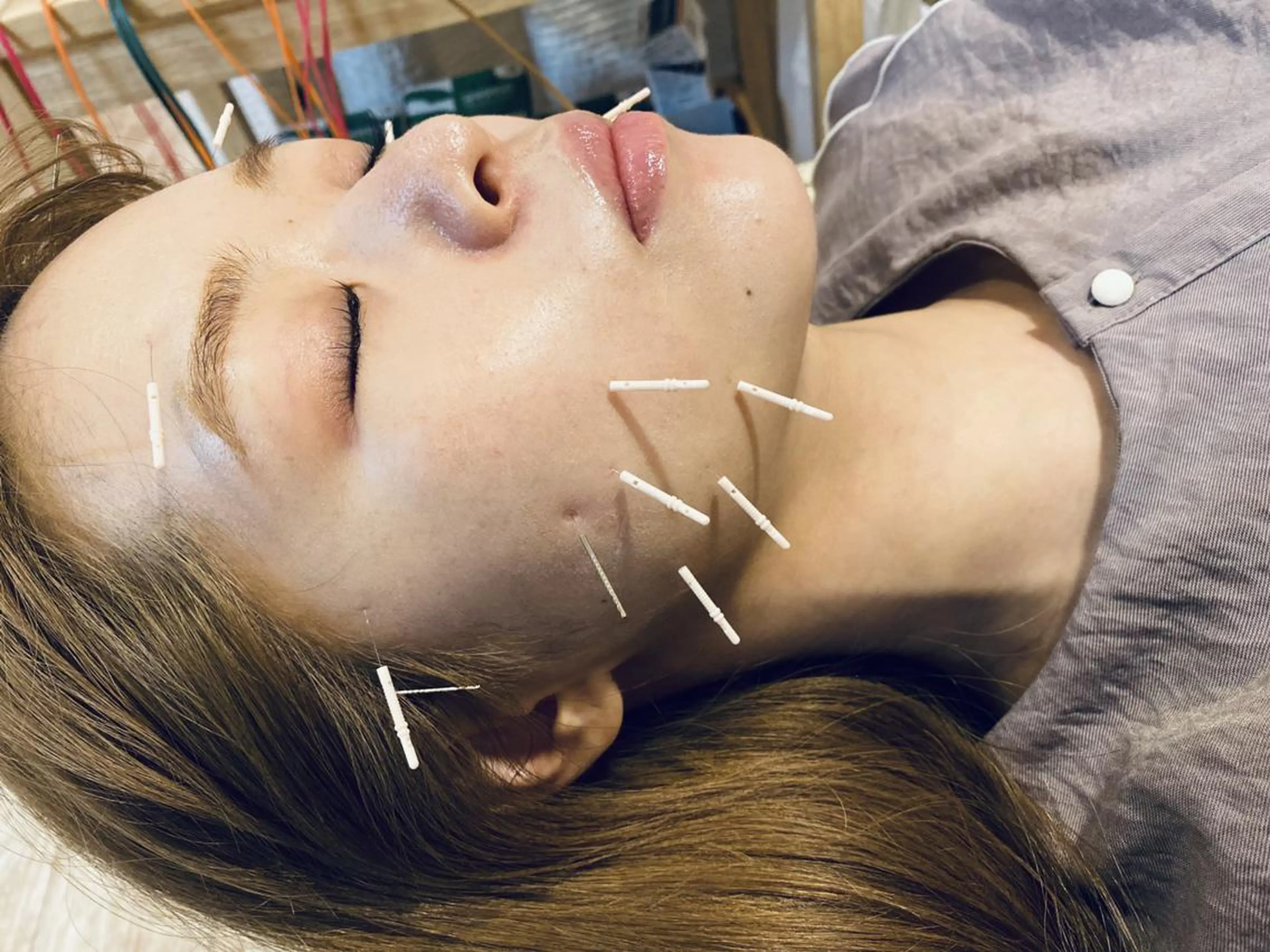 むくみたるみ専門☆ 美容鍼・小顔矯正のエステ・リラクイメージ